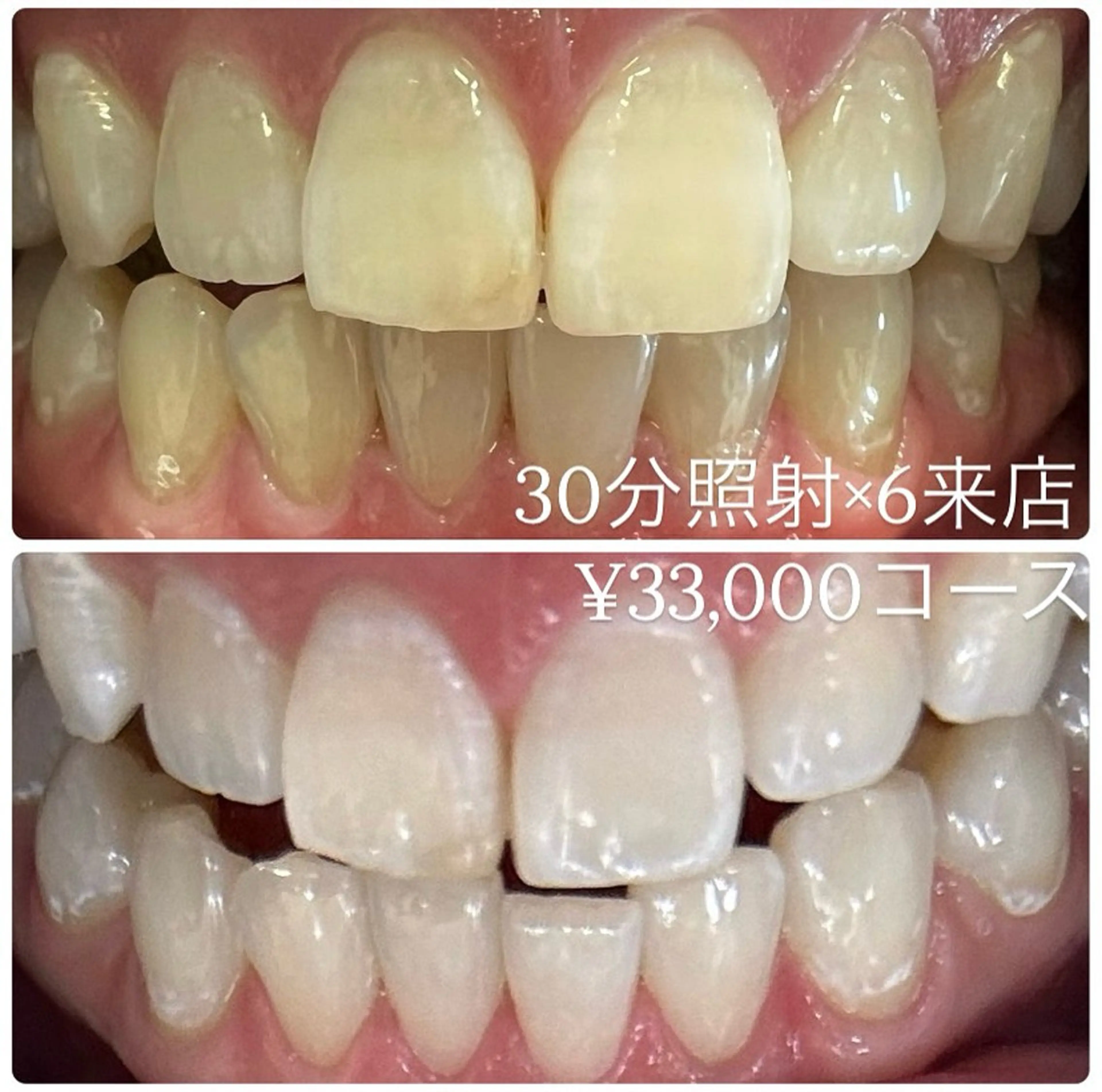 ホワイトニングルーム 横浜店のその他イメージ