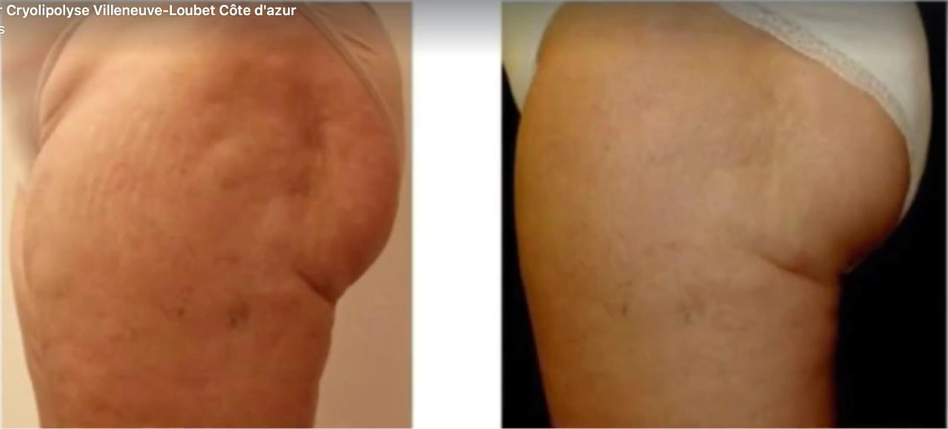 ANRIRE (アンリール)のエステ・リラクイメージ