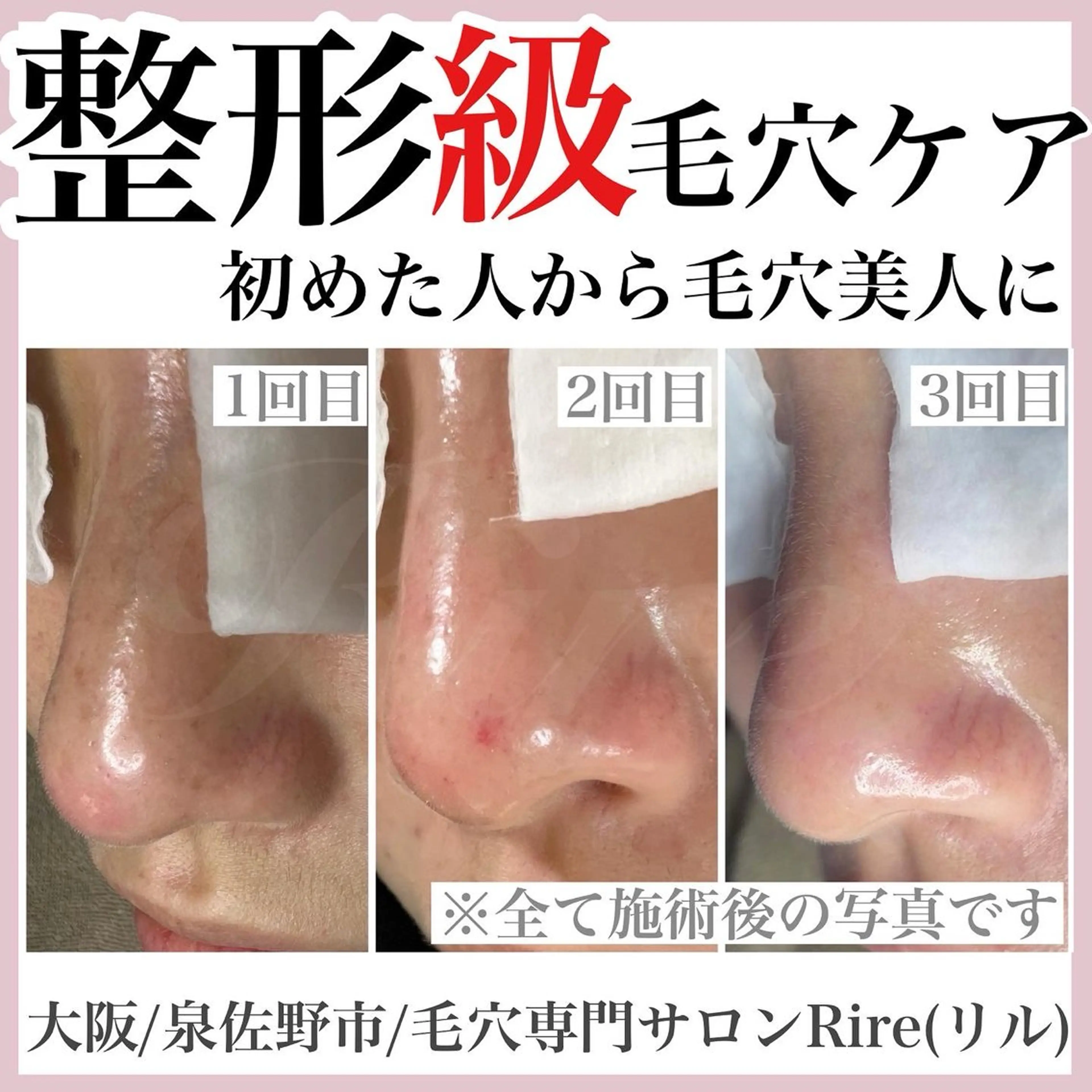 エステ 隅田 都布子のマツエク・マツパデザイン