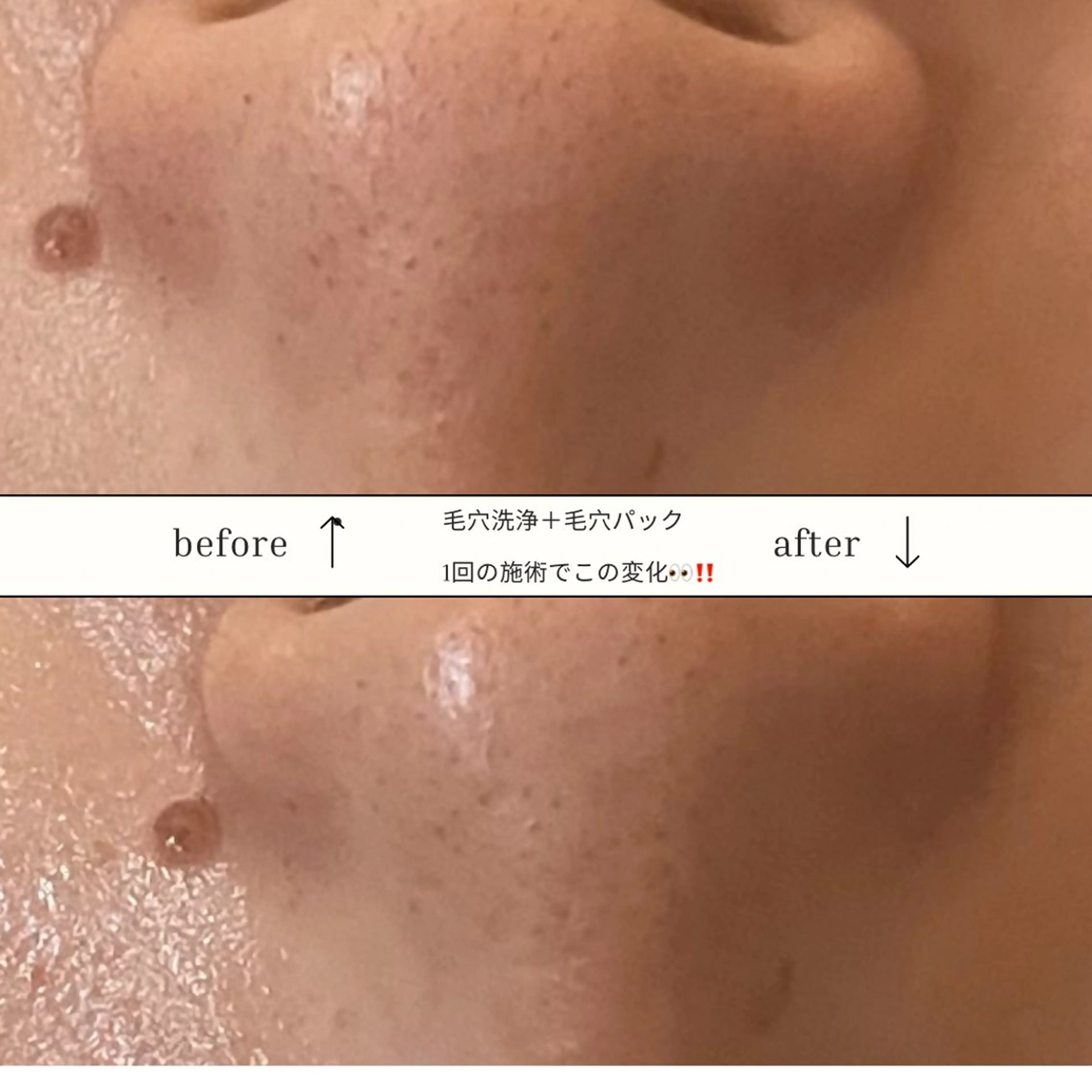 エステ リラク skinLabo所属・saya Mのエステ・リラクイメージ