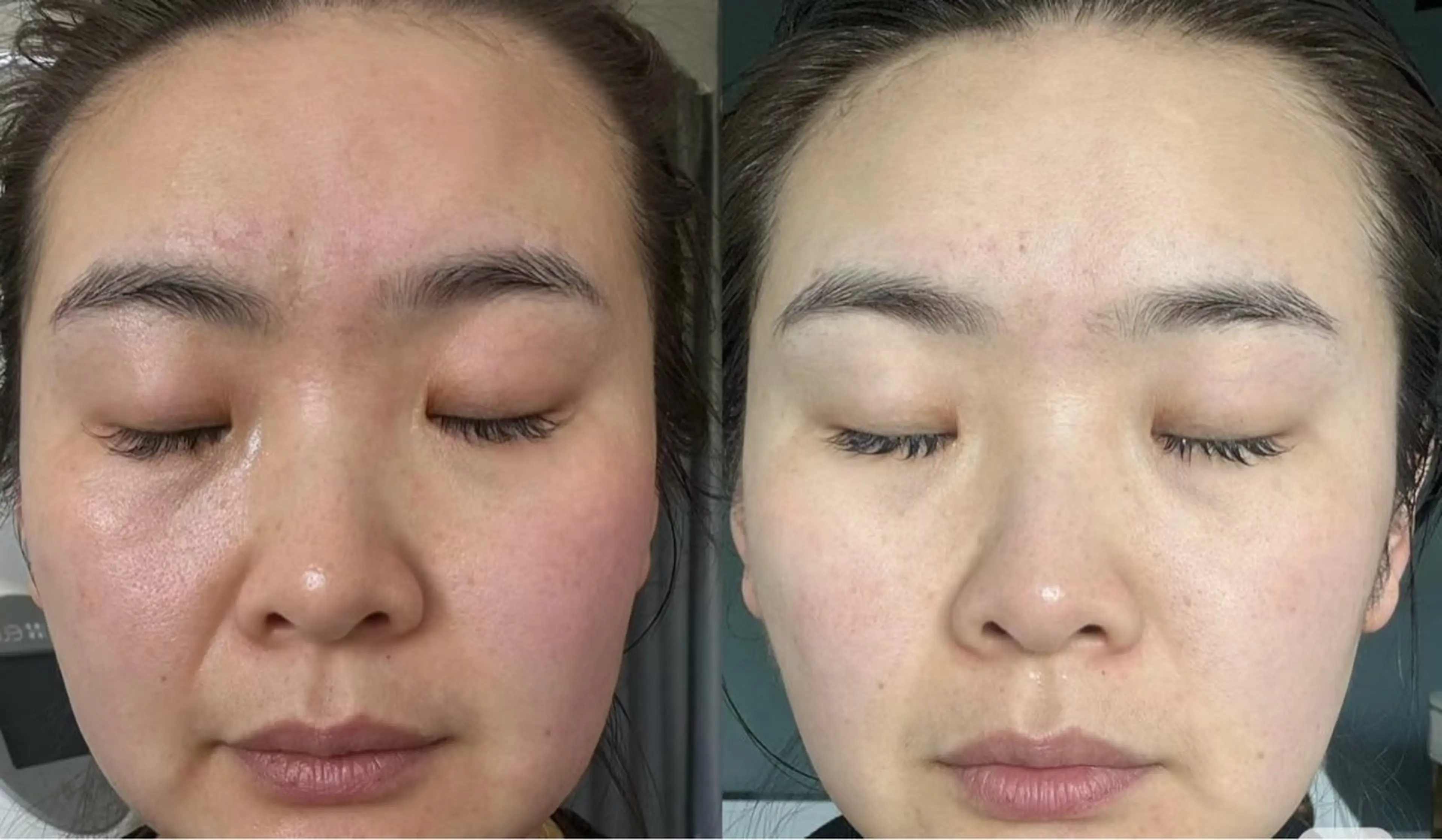 カラー エステ aliaハイフ&水光ジェットサロン所属・aliaハーブ水光店 エステティシャン募集のエステ・リラクイメージ