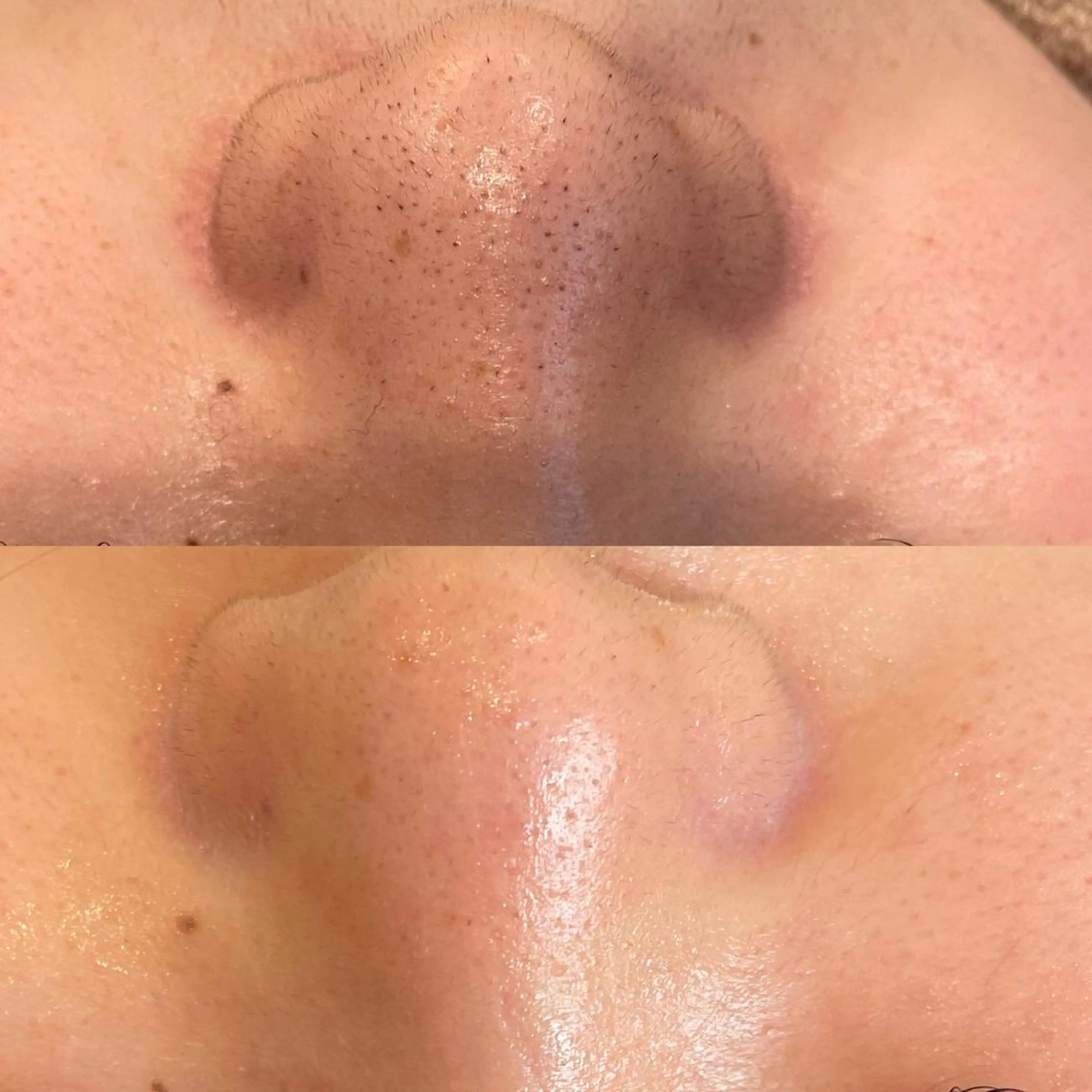 VERY VERY 九条店のエステ・リラクイメージ