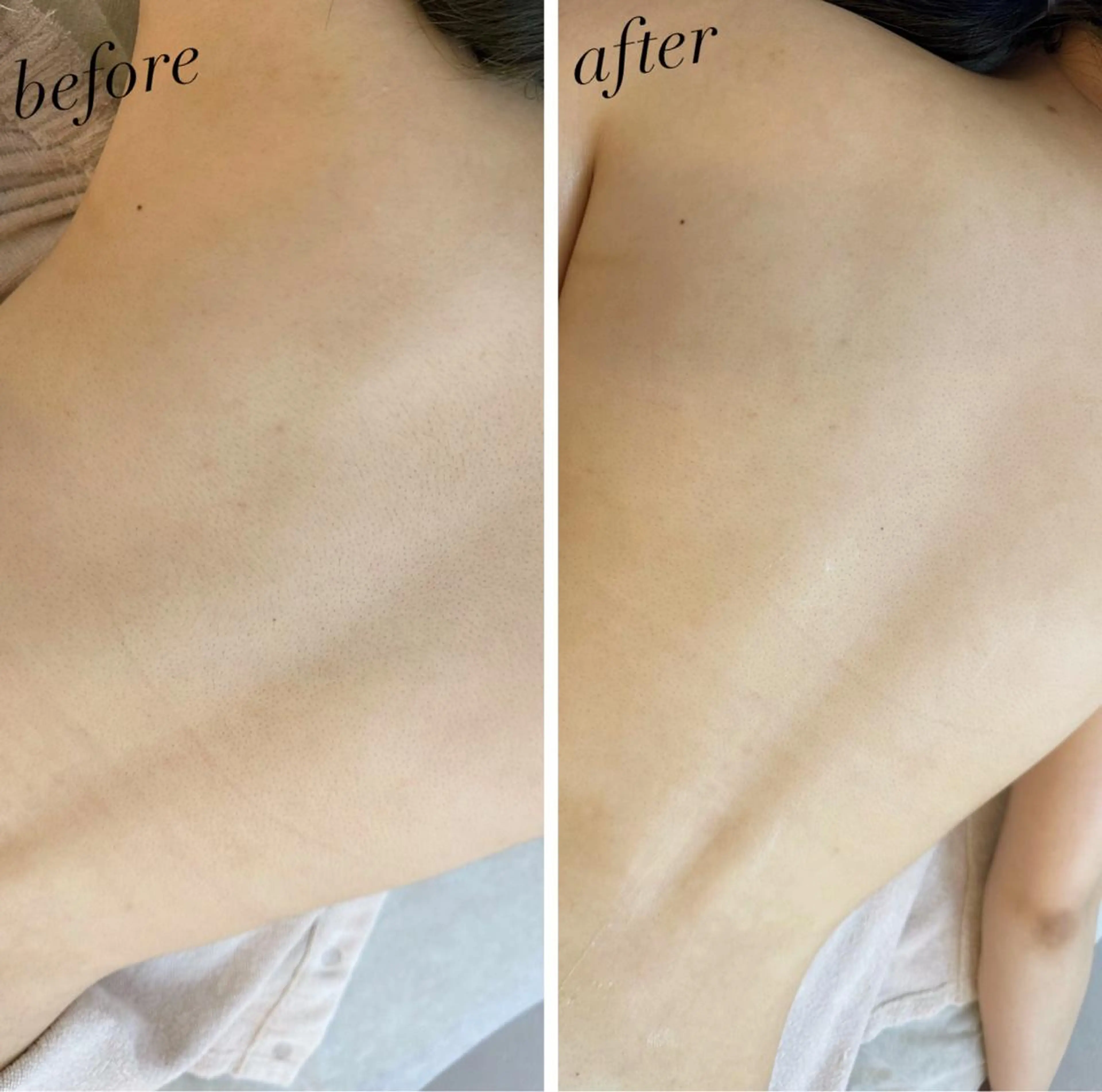 うなじ脱毛/美肌脱毛 LABELのエステ・リラクイメージ