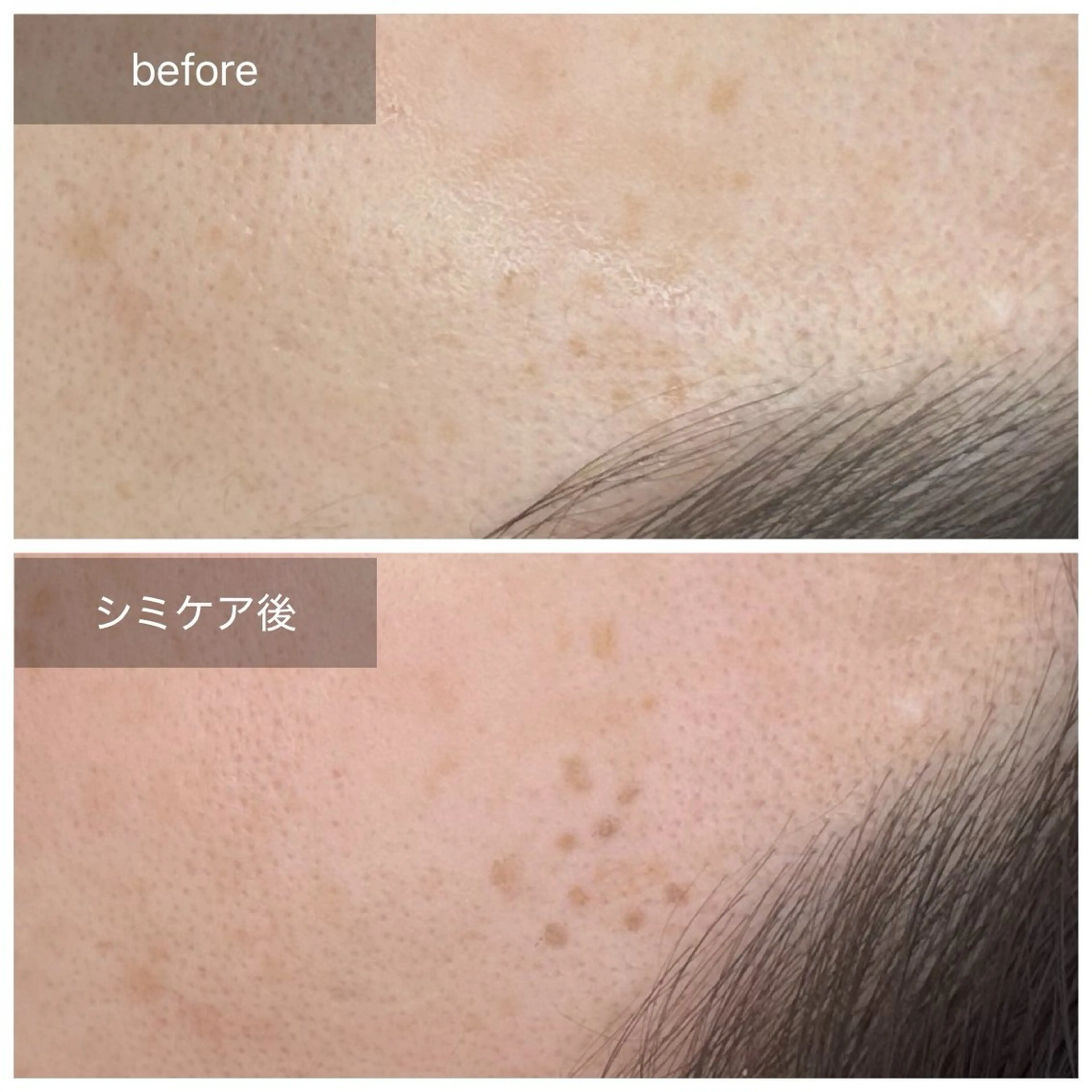 トータルしみケア専門 NICA(ニカ)の眉毛・アイブロウイメージ