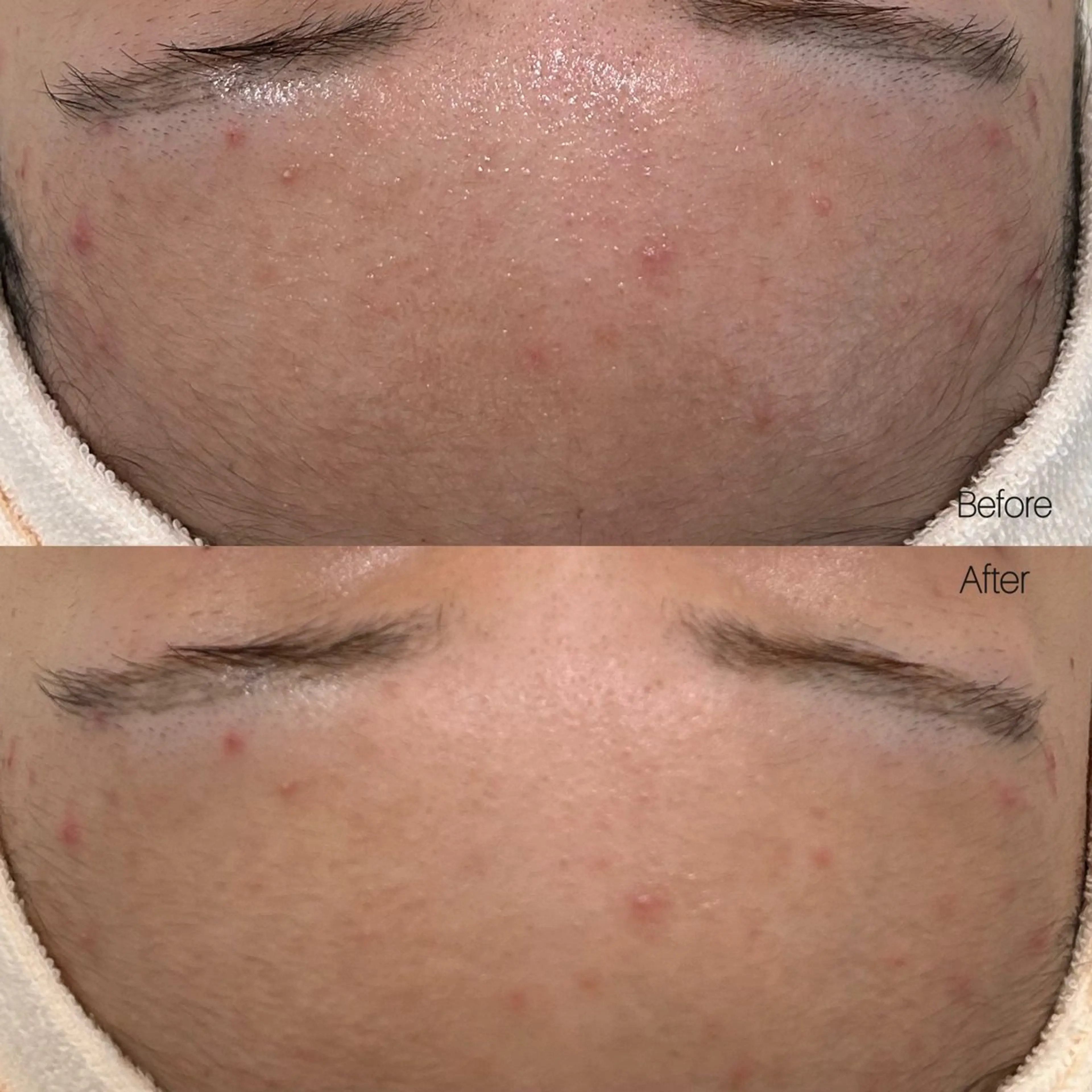 etre - 韓国肌管理 -のエステ・リラクイメージ