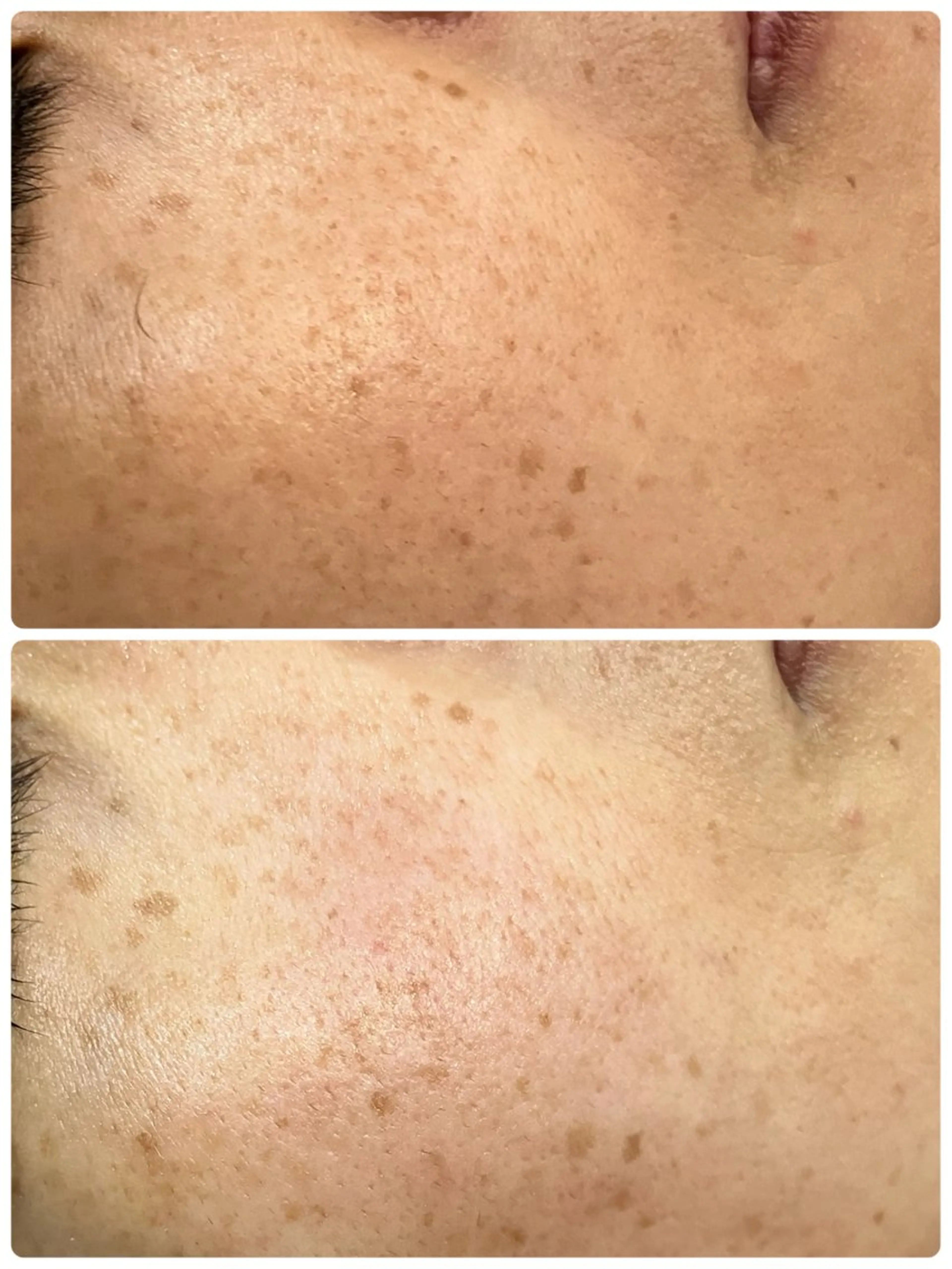 温活美肌専門サロン Lien『リアン』のエステ・リラクイメージ