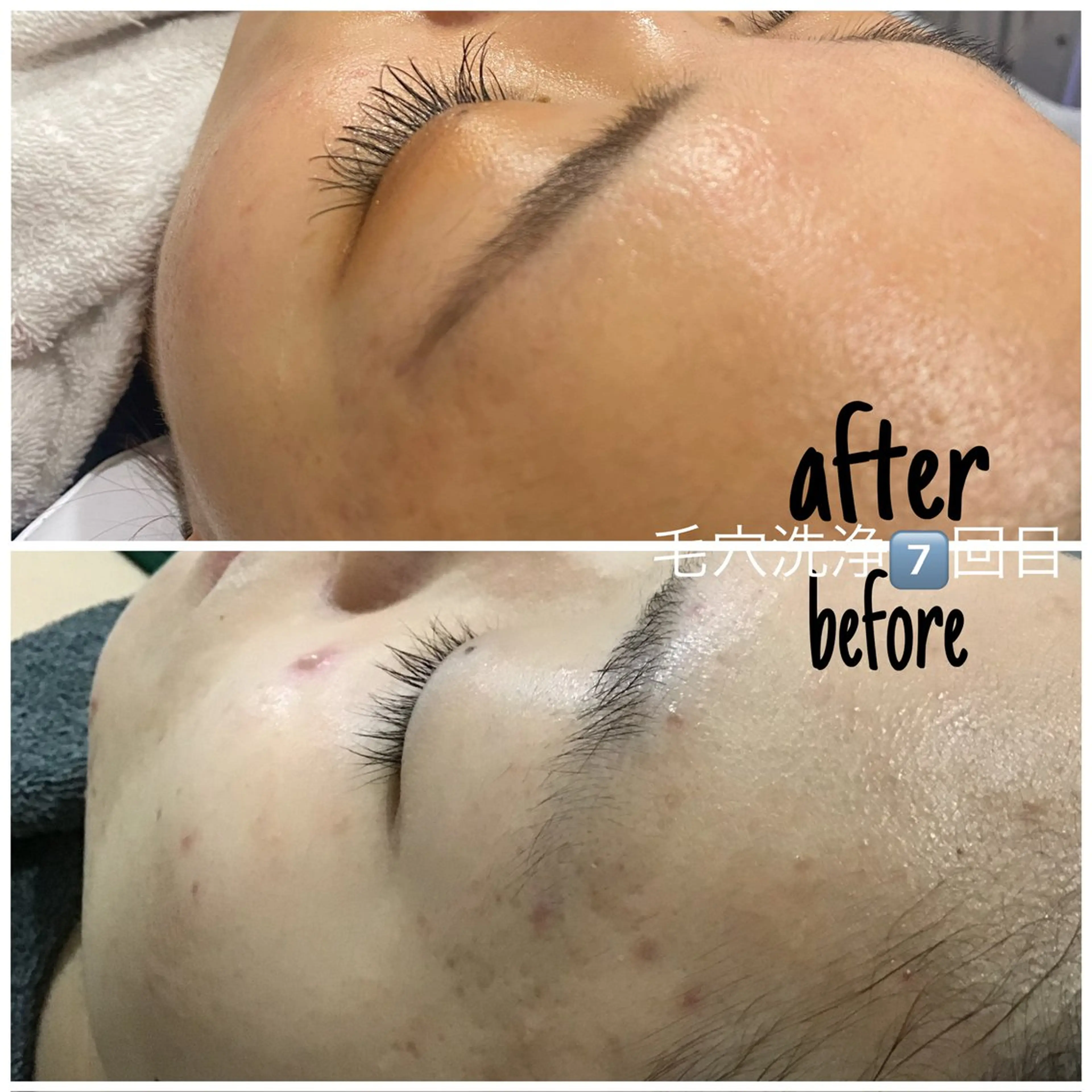 エステ 毛穴洗浄・痩身・脱毛 /アルカンジュのエステ・リラクイメージ