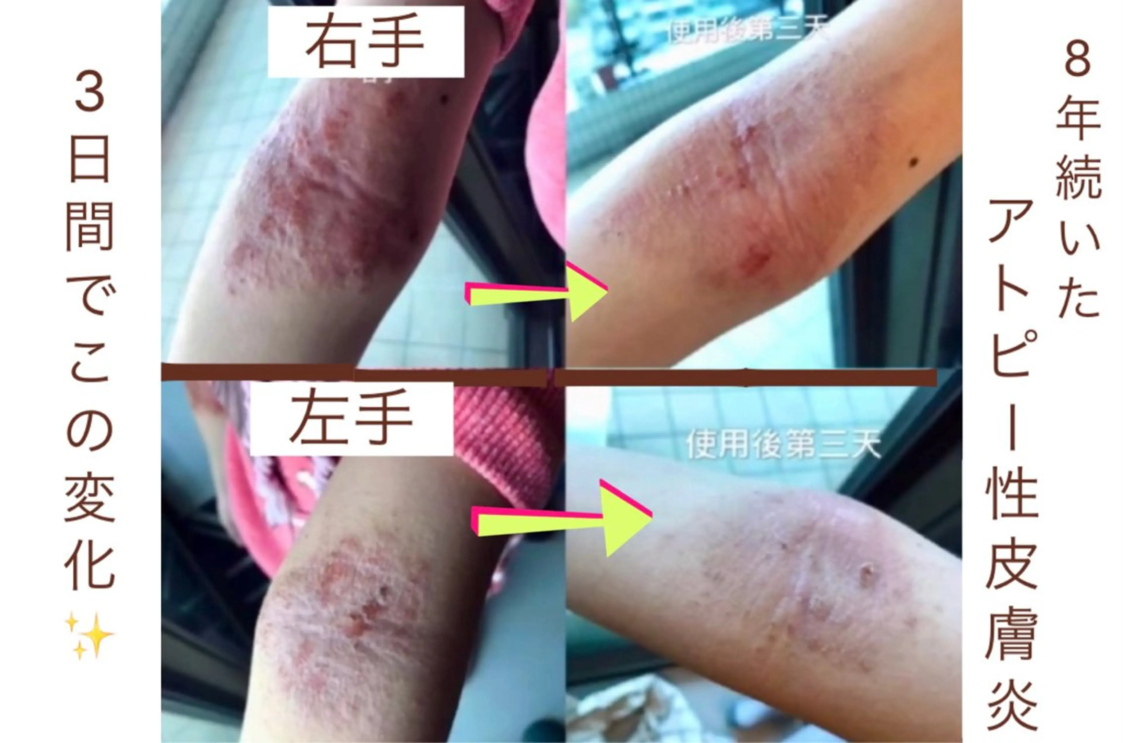 【肌トラブルケア 60分】ボディケアの施術付き！の写真