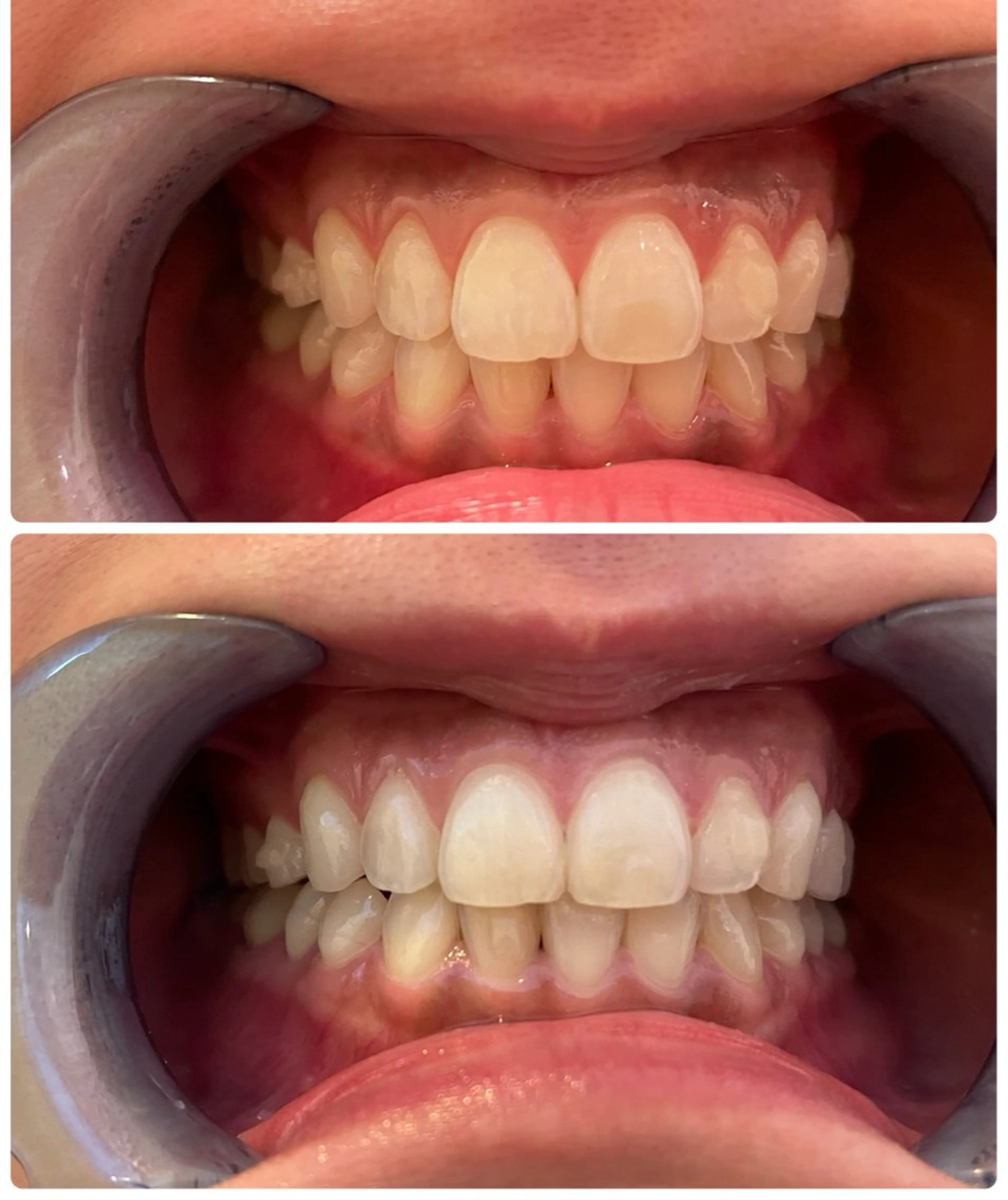 ネイル ホワイト DIAMOND BEAUYのその他イメージ