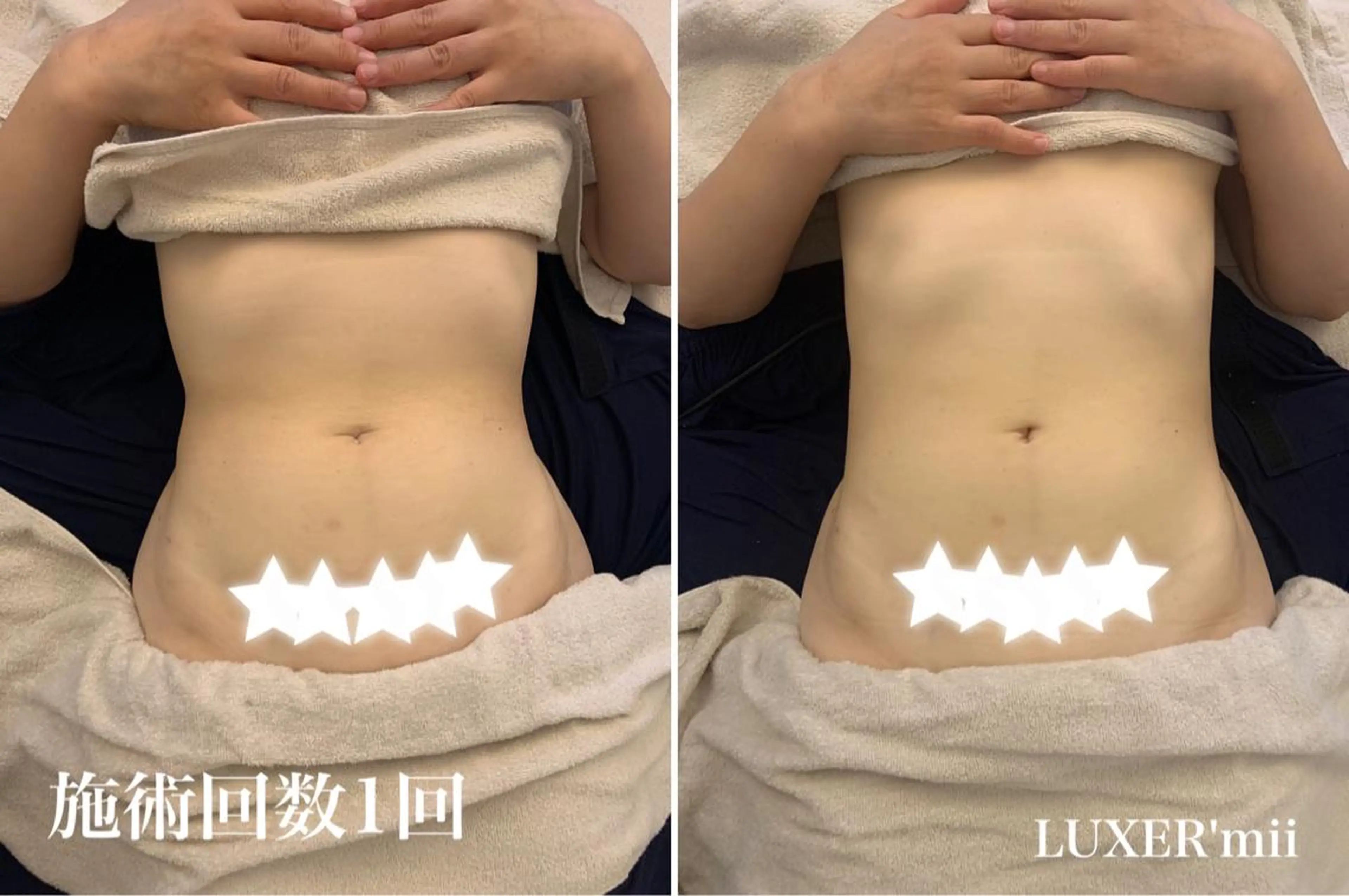 目指せ全身バランス美人！WINBACK＋全身コルギ　155分　骨盤矯正、デコルテ付の写真