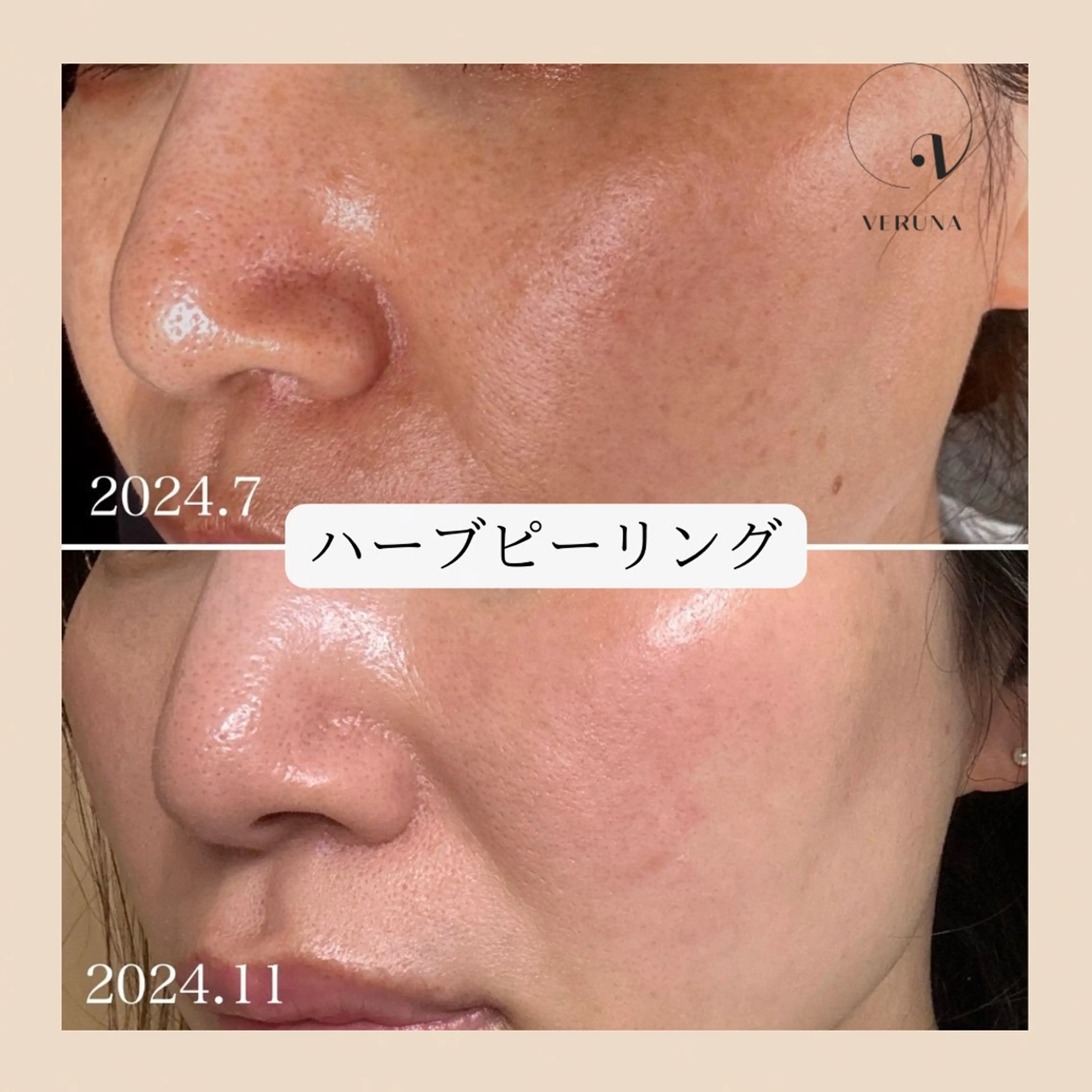 ピーリング専門店 Belluteのエステ・リラクイメージ