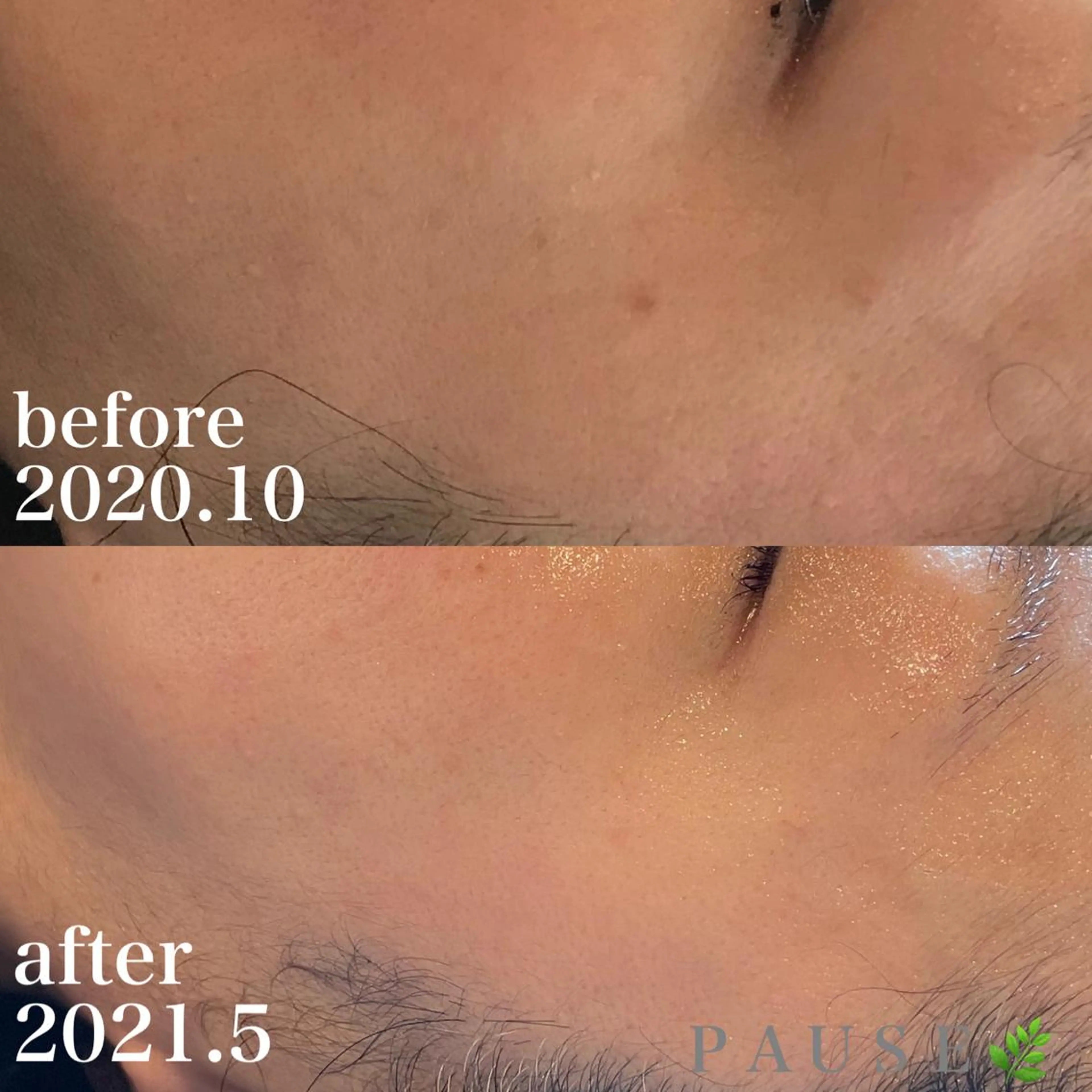 エステ 浜野 恵美のエステ・リラクイメージ