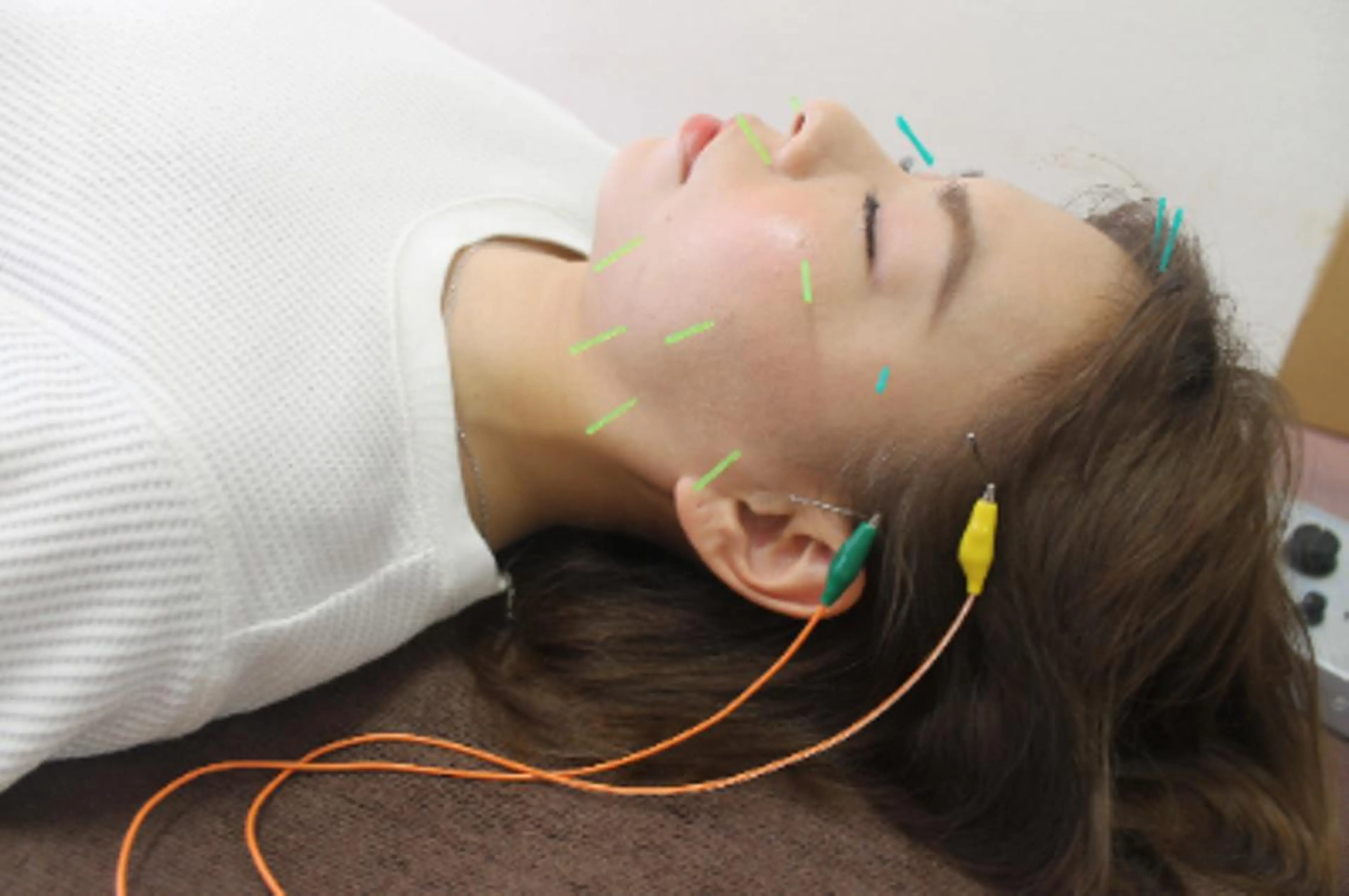 同心整骨院 美容鍼・整体・小顔のエステ・リラクイメージ