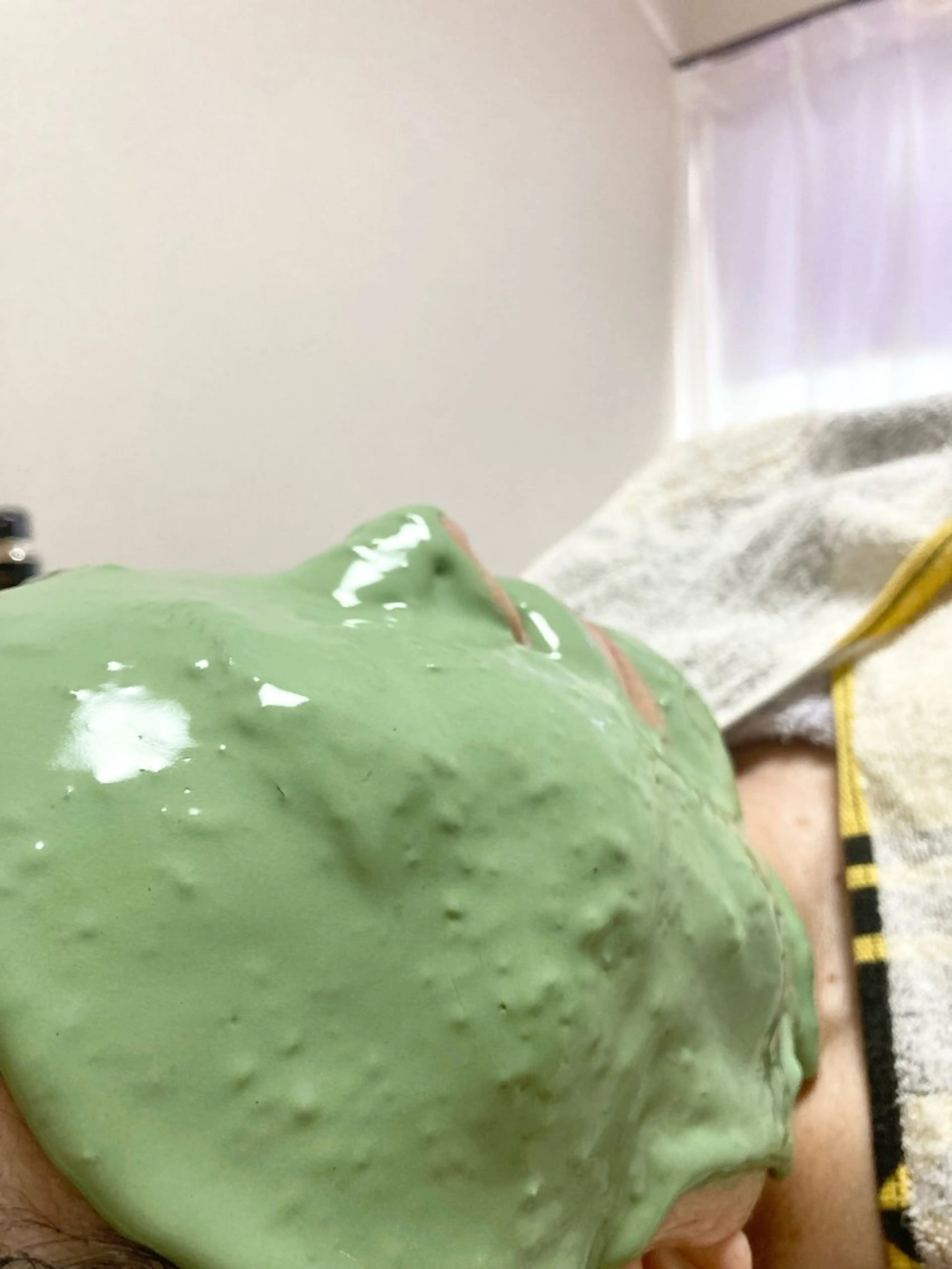 イルネージュ﻿使用アドバンスコース＋ビューネケアパック(初回お試し)の写真