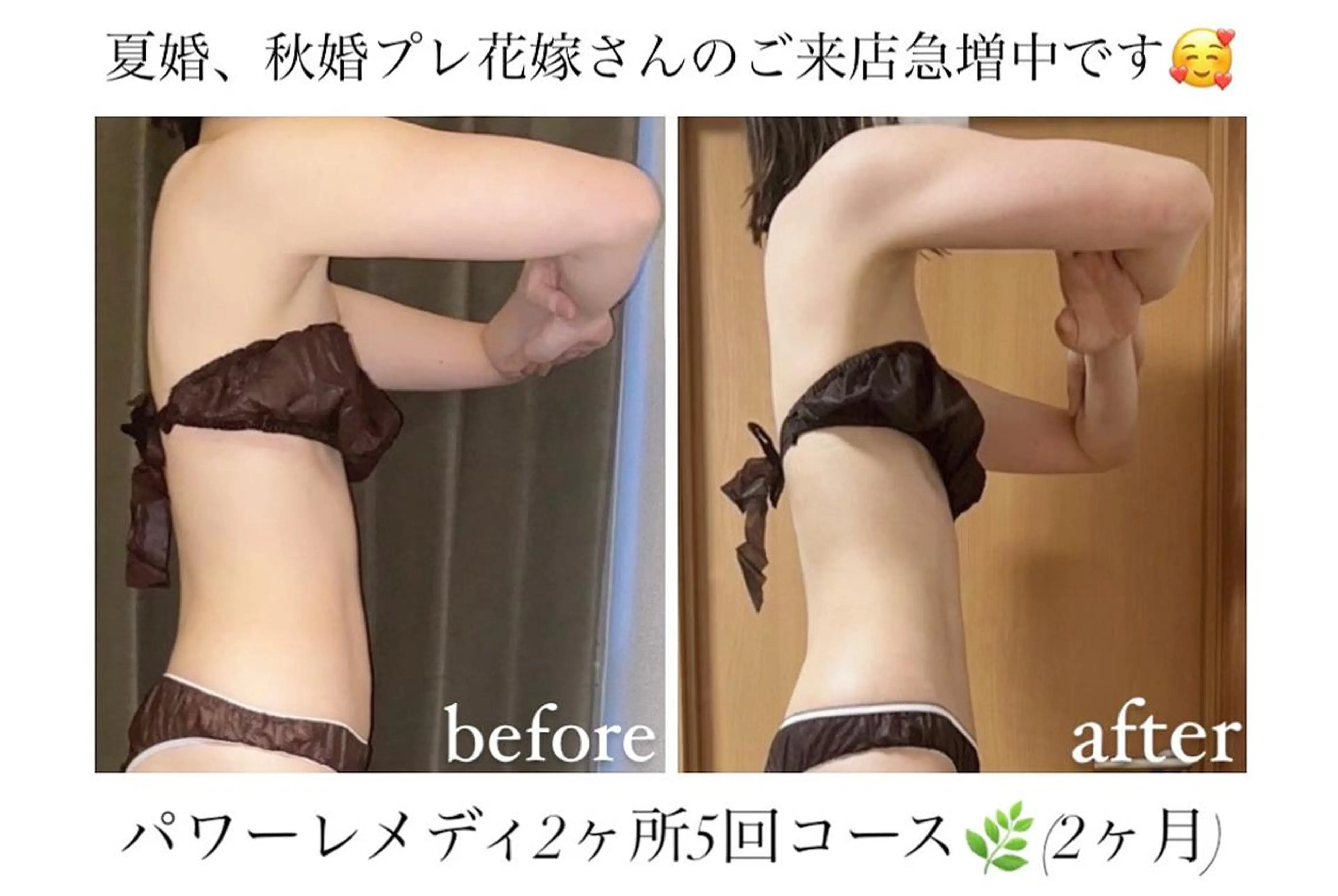 biloop所属・《本気痩せ×疲労改善 》 BILOOPのエステ・リラクイメージ