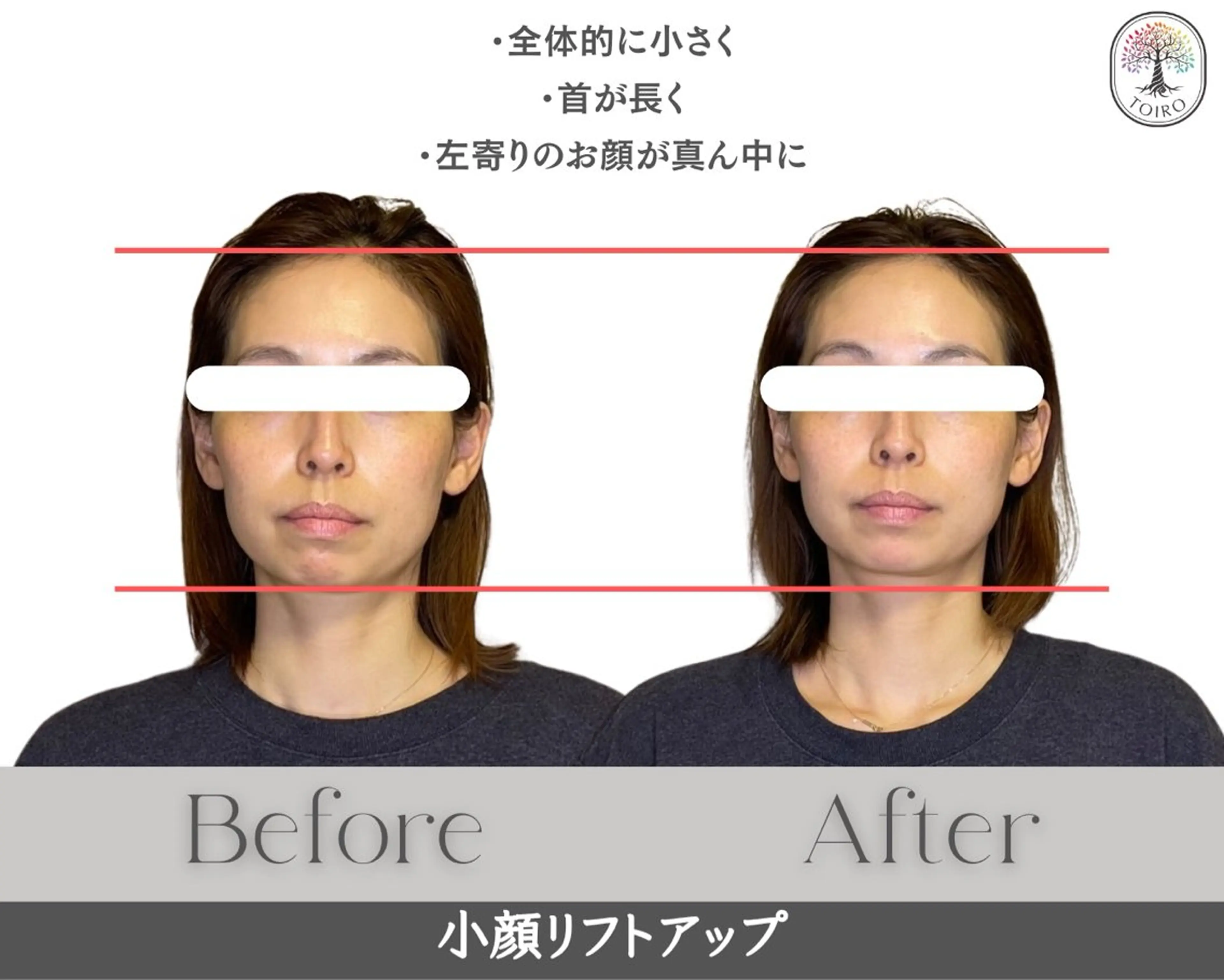 ヘッドスパ・小顔矯正 十色　横浜のエステ・リラクイメージ