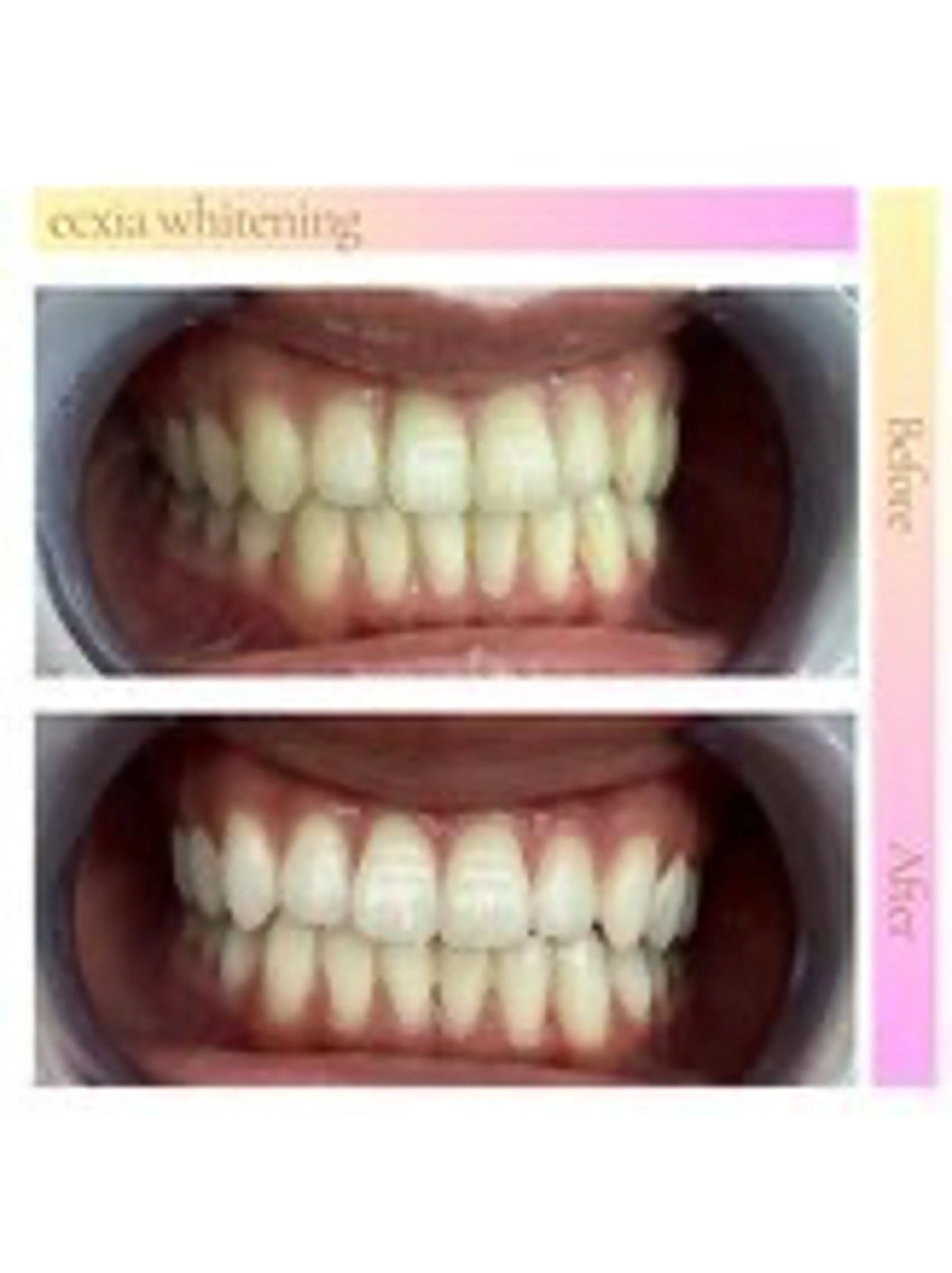 セルフホワイトニング エクシア西宮北口店のその他イメージ