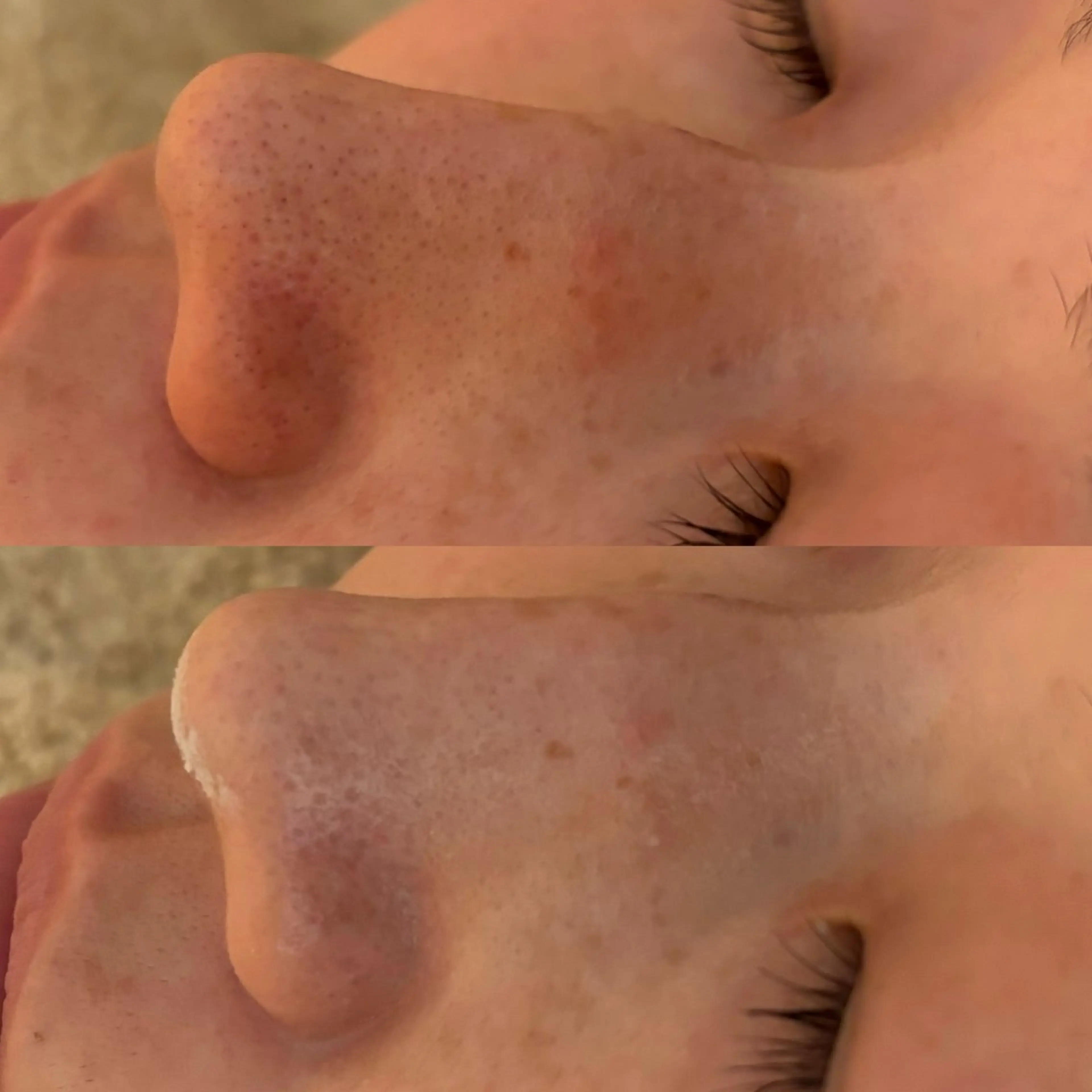 エステ リラク デアイム東広島所属・中井 小春のエステ・リラクイメージ