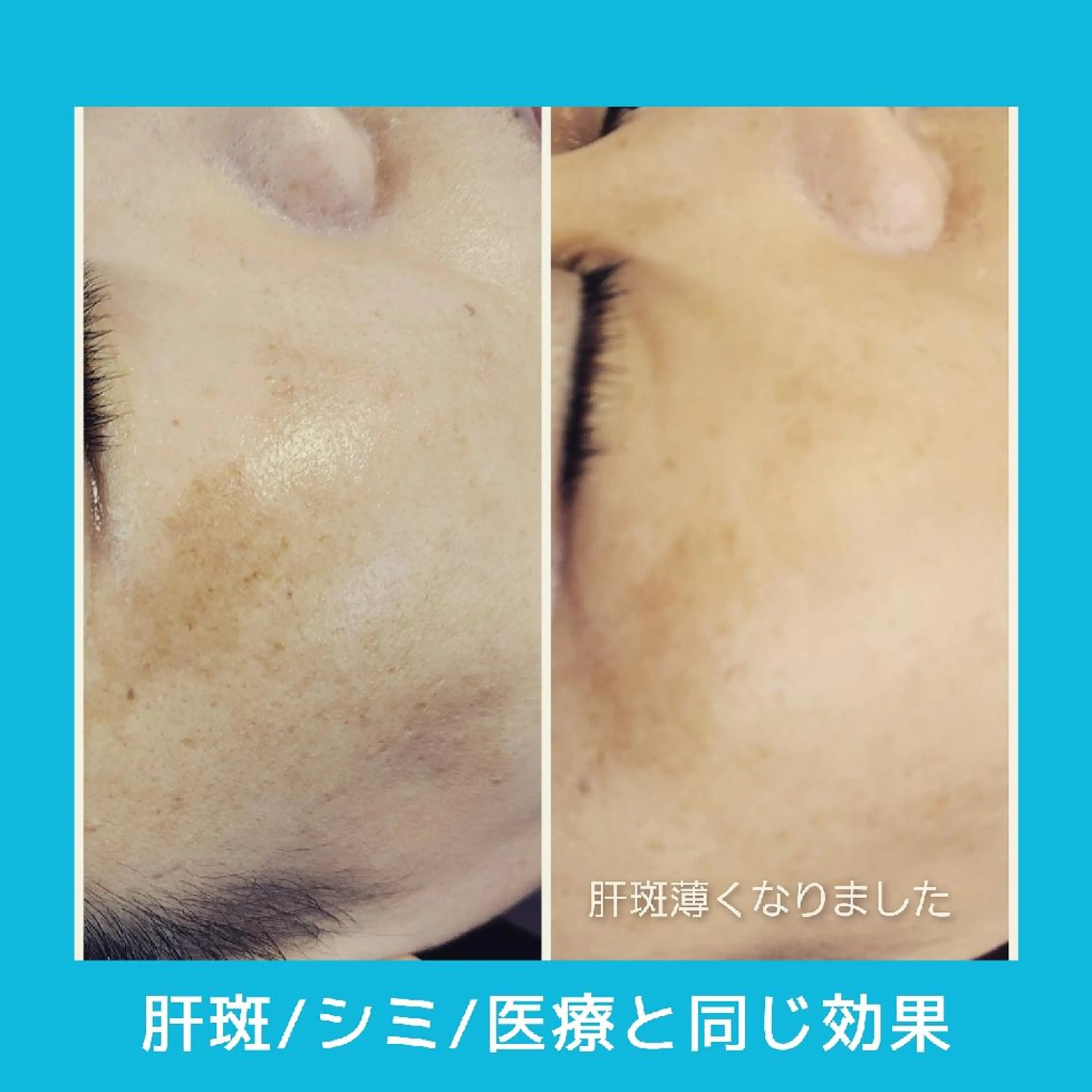 【トータル美容】 Eternityのその他イメージ