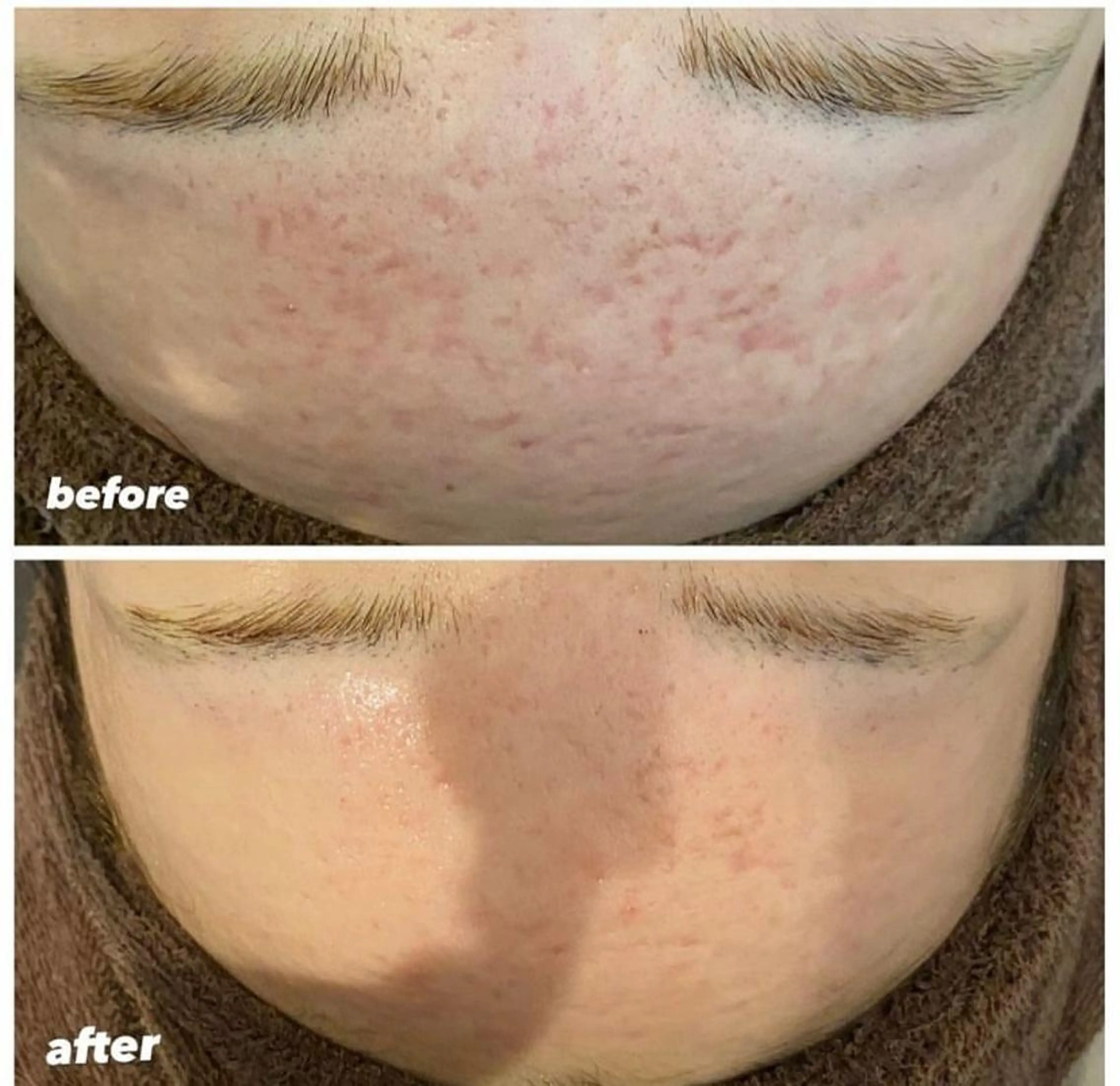 本気の肌質改善スキン デトックス🌿のエステ・リラクイメージ