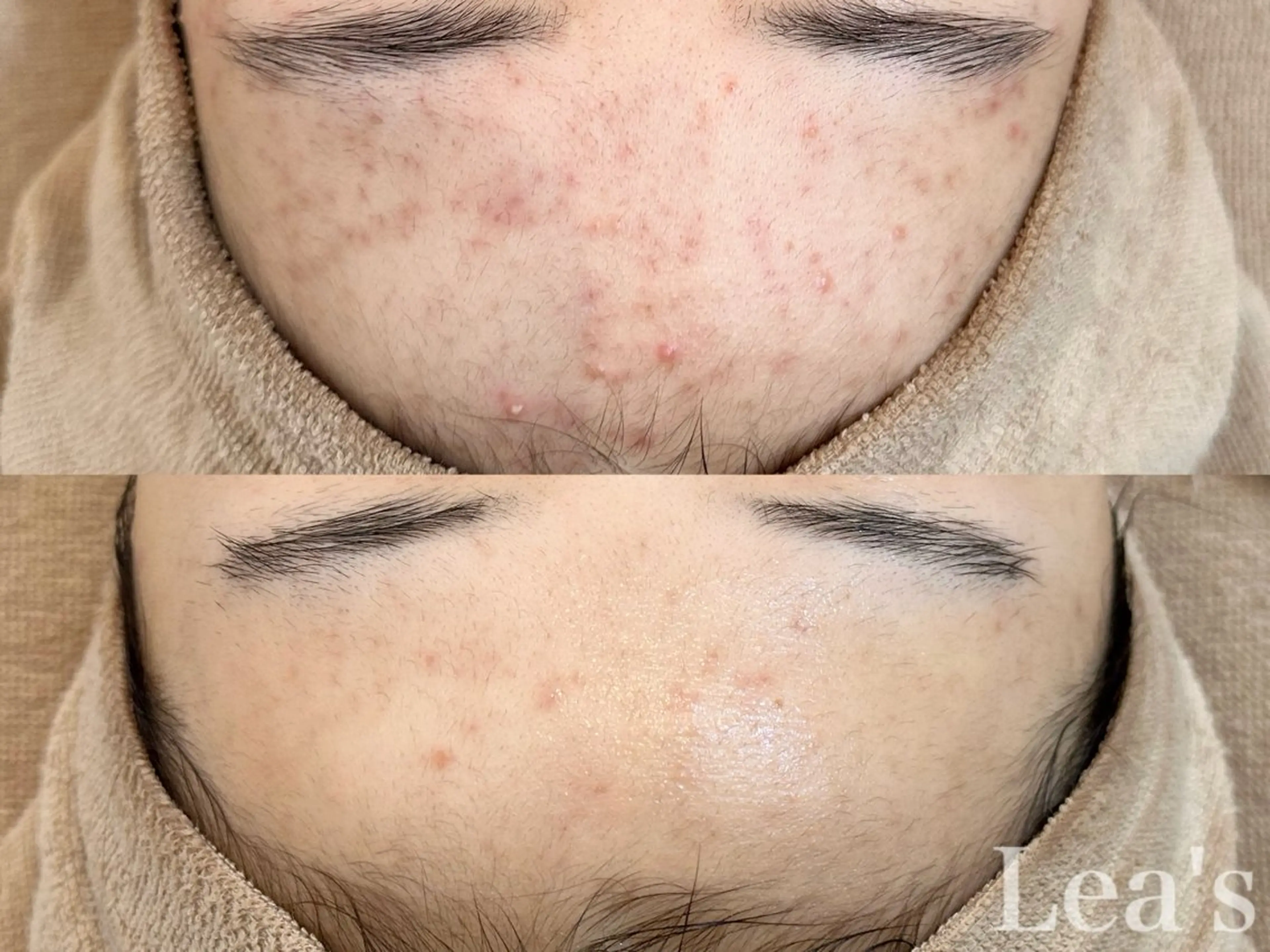 【Lea's 】 hazukiのエステ・リラクイメージ