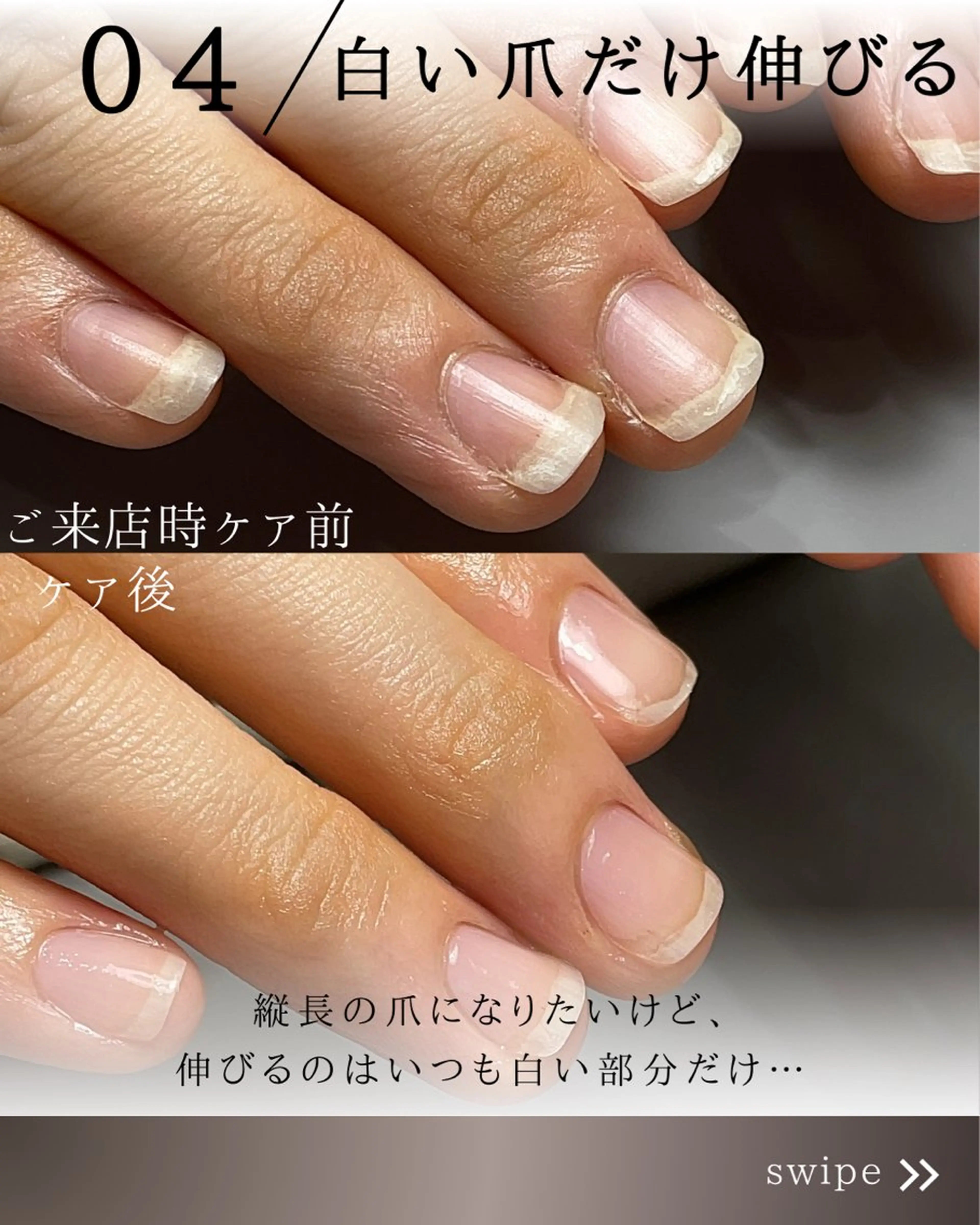 ネイル Aim* 深爪自爪育成専門店のネイルデザイン