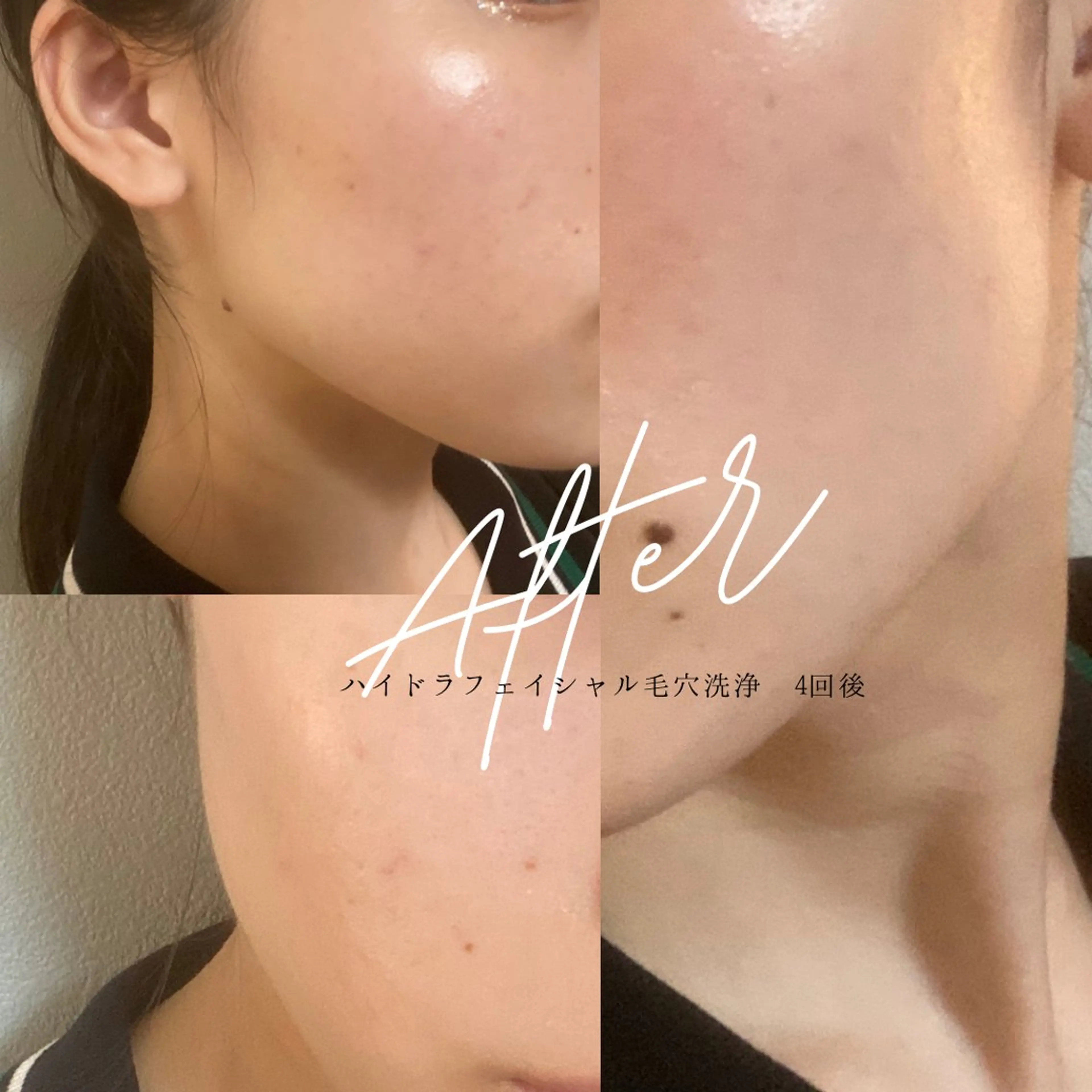 【肌質改善・腸揉み】 Nico laughのエステ・リラクイメージ