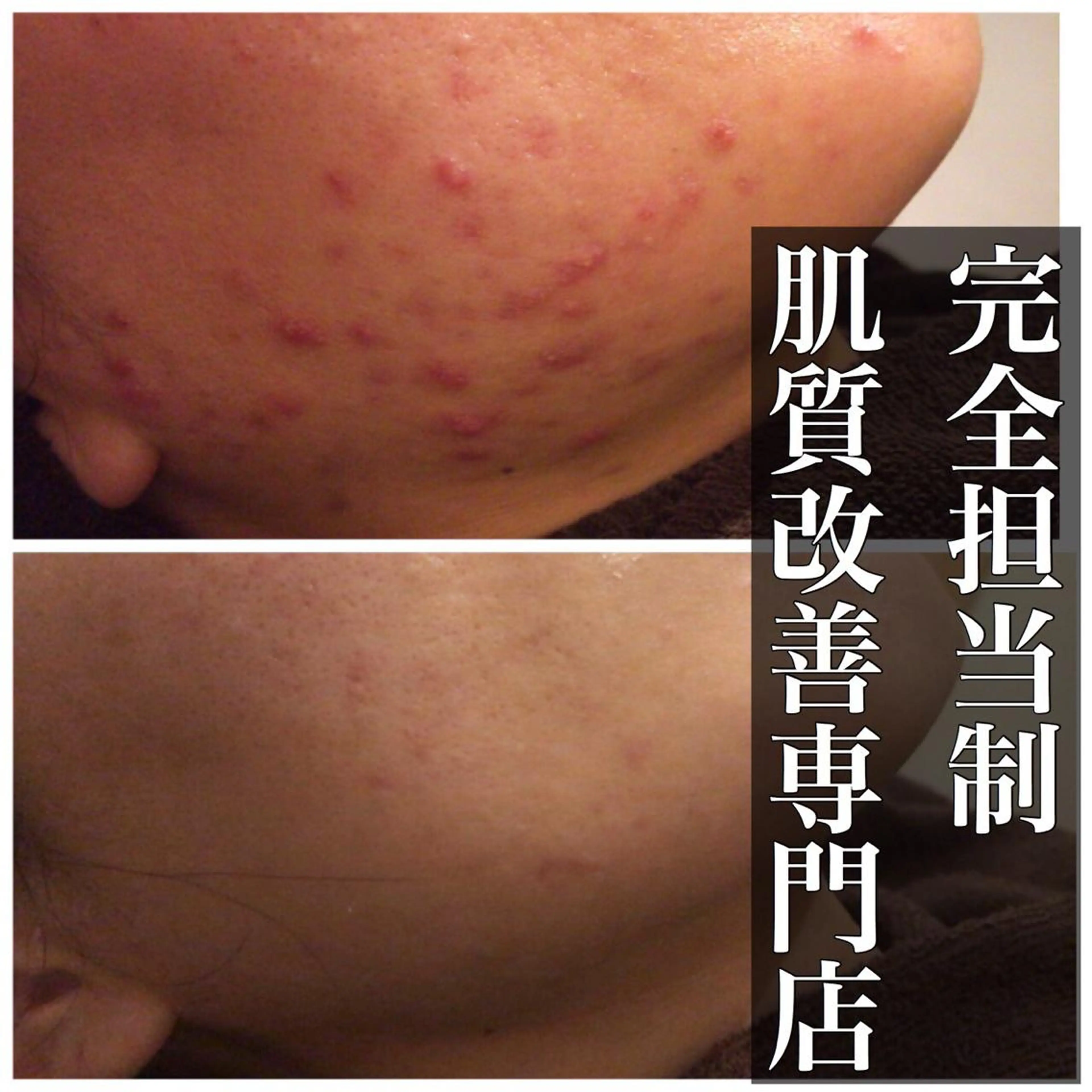 ミディアム カラー パーマ ヘアアレンジ メンズ キッズ ネイル マツエク・マツパ エステ リラク ニキビ・肌質改善専門 ♡人生が変わるサロンのエステ・リラクイメージ