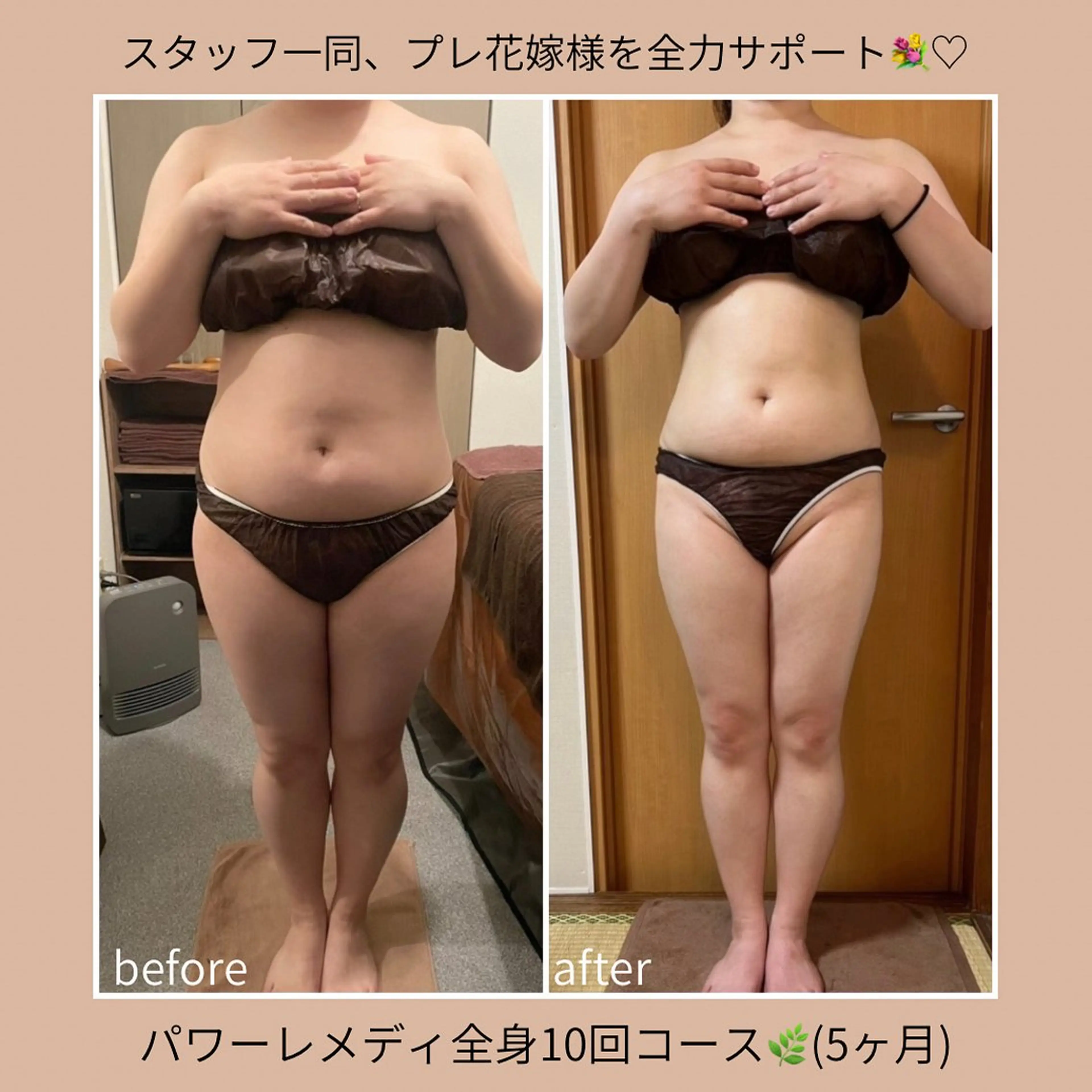 《本気痩せ×疲労改善 》  BILOOPのエステ・リラクイメージ