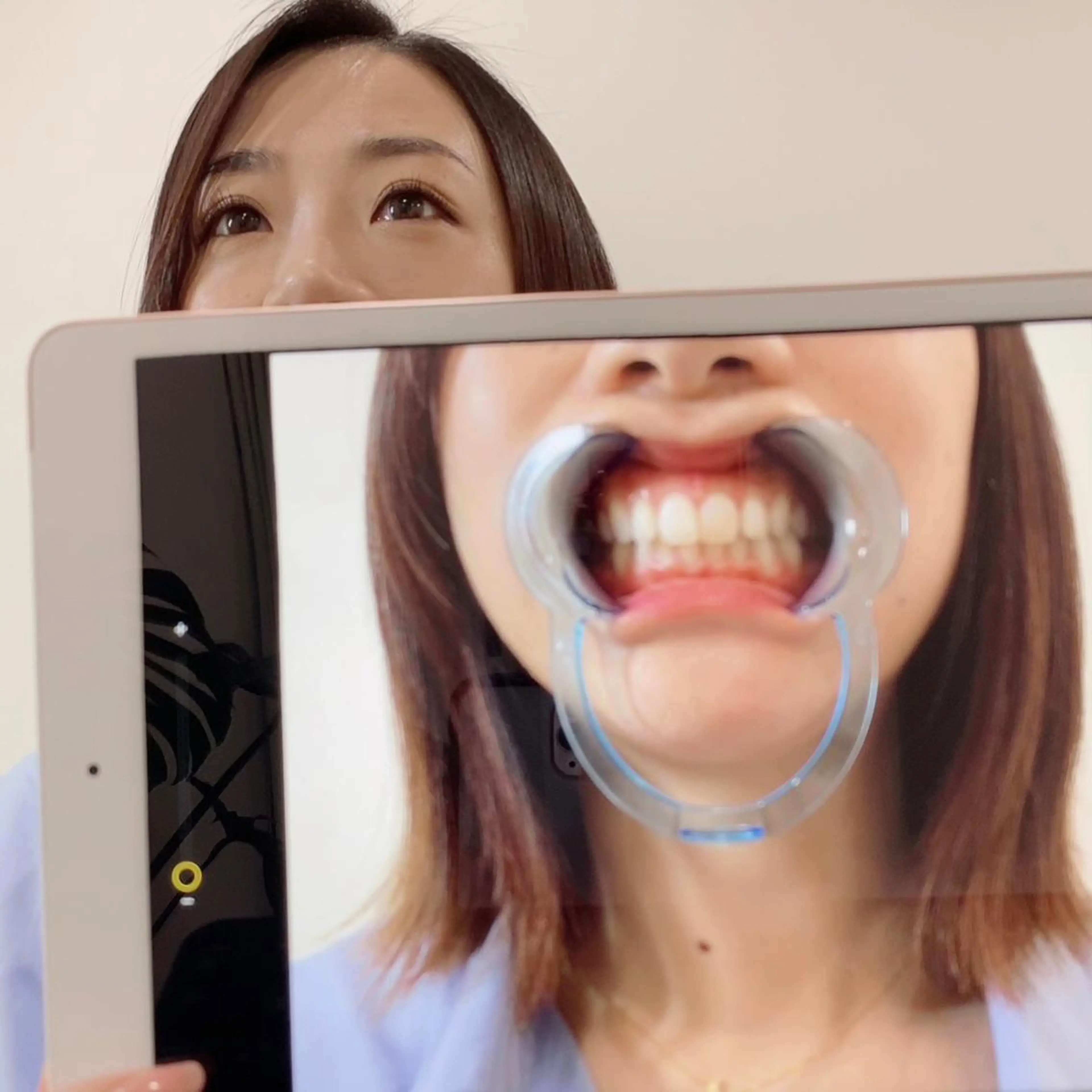 セルフホワイトニング 🦷口元垢抜け✨のその他イメージ