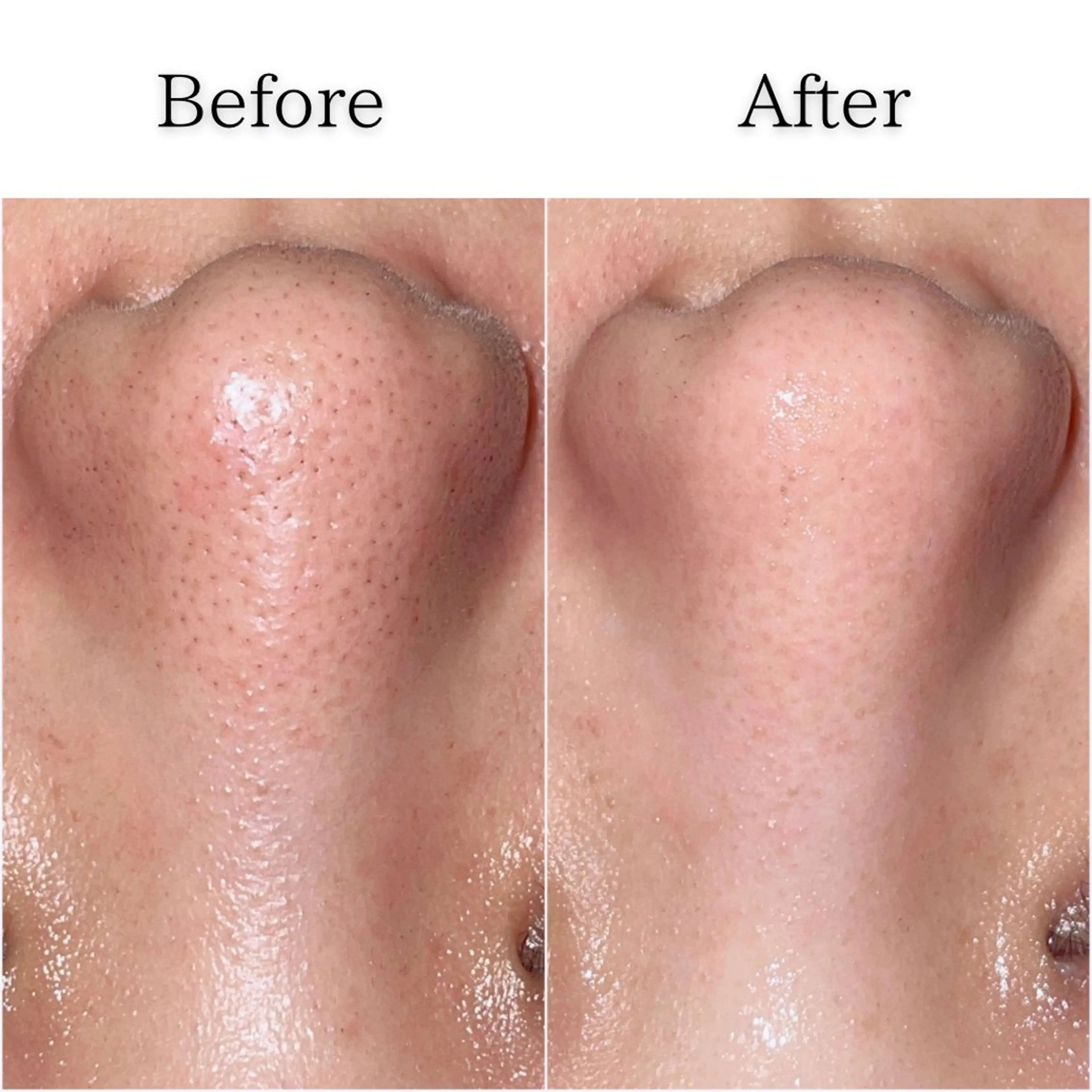 エステ gracia 浦添店のその他イメージ