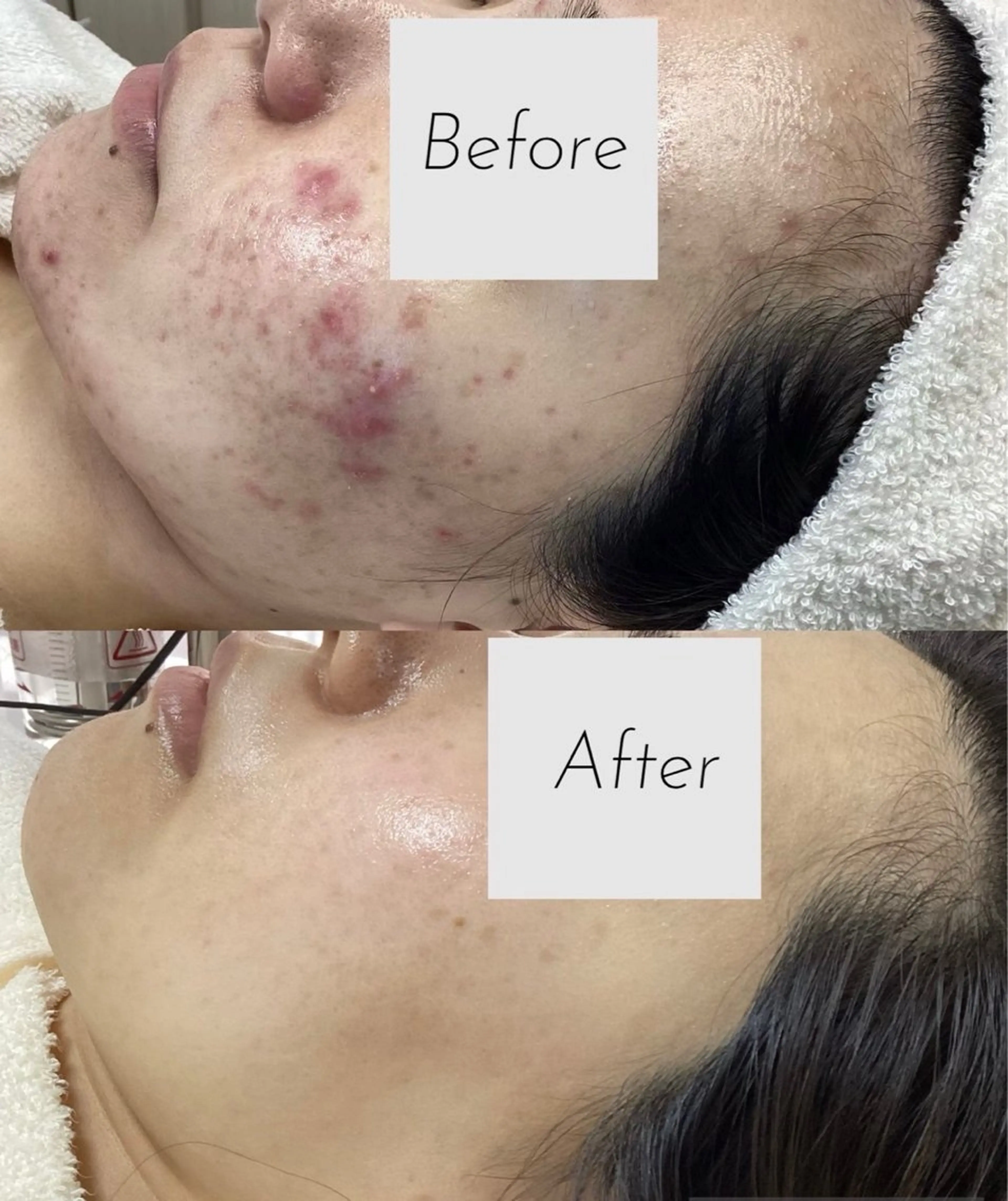 都度払い 肌質改善専門サロンのエステ・リラクイメージ