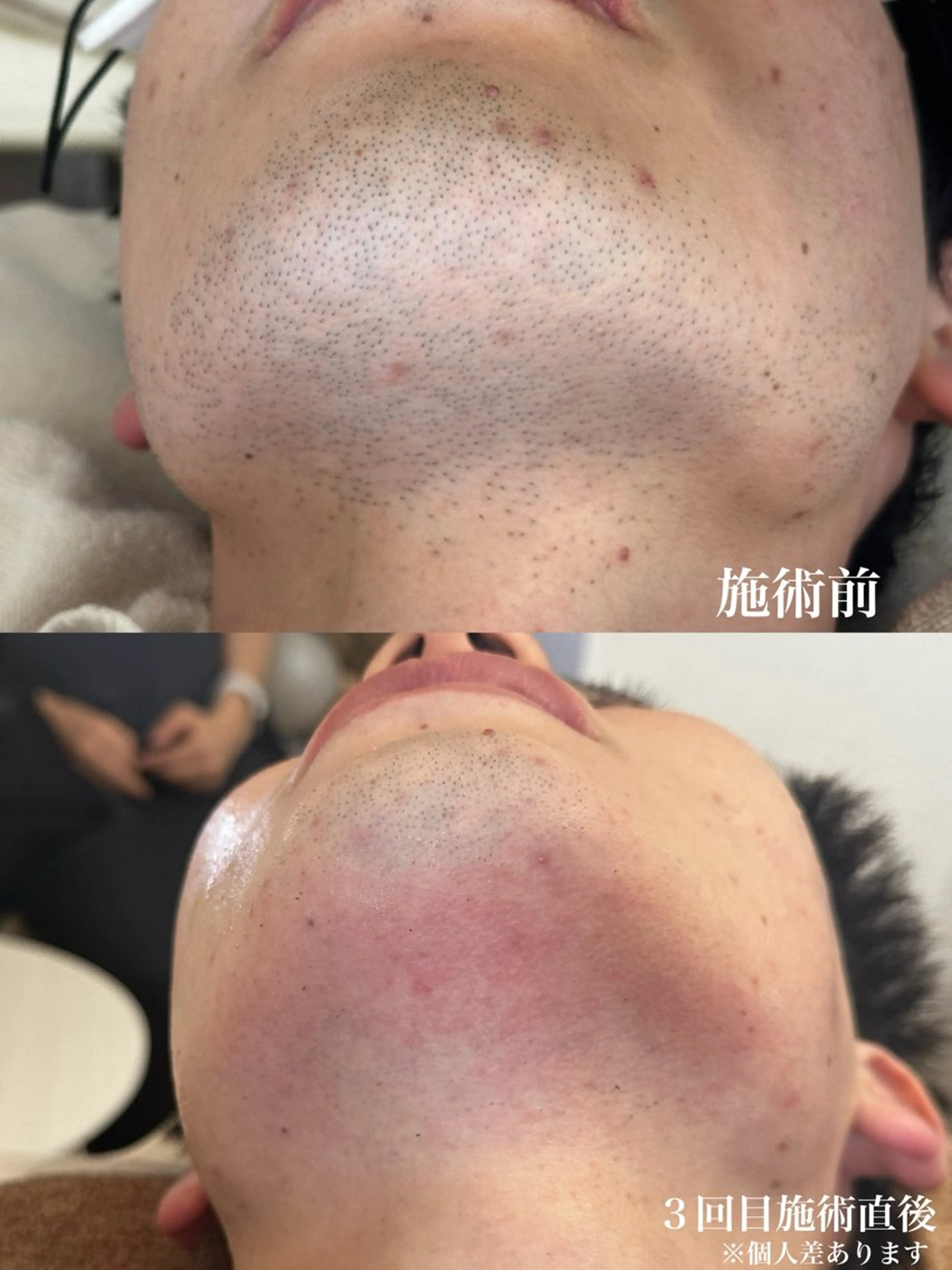 メンズ muumo所属・muumo まりののエステ・リラクイメージ