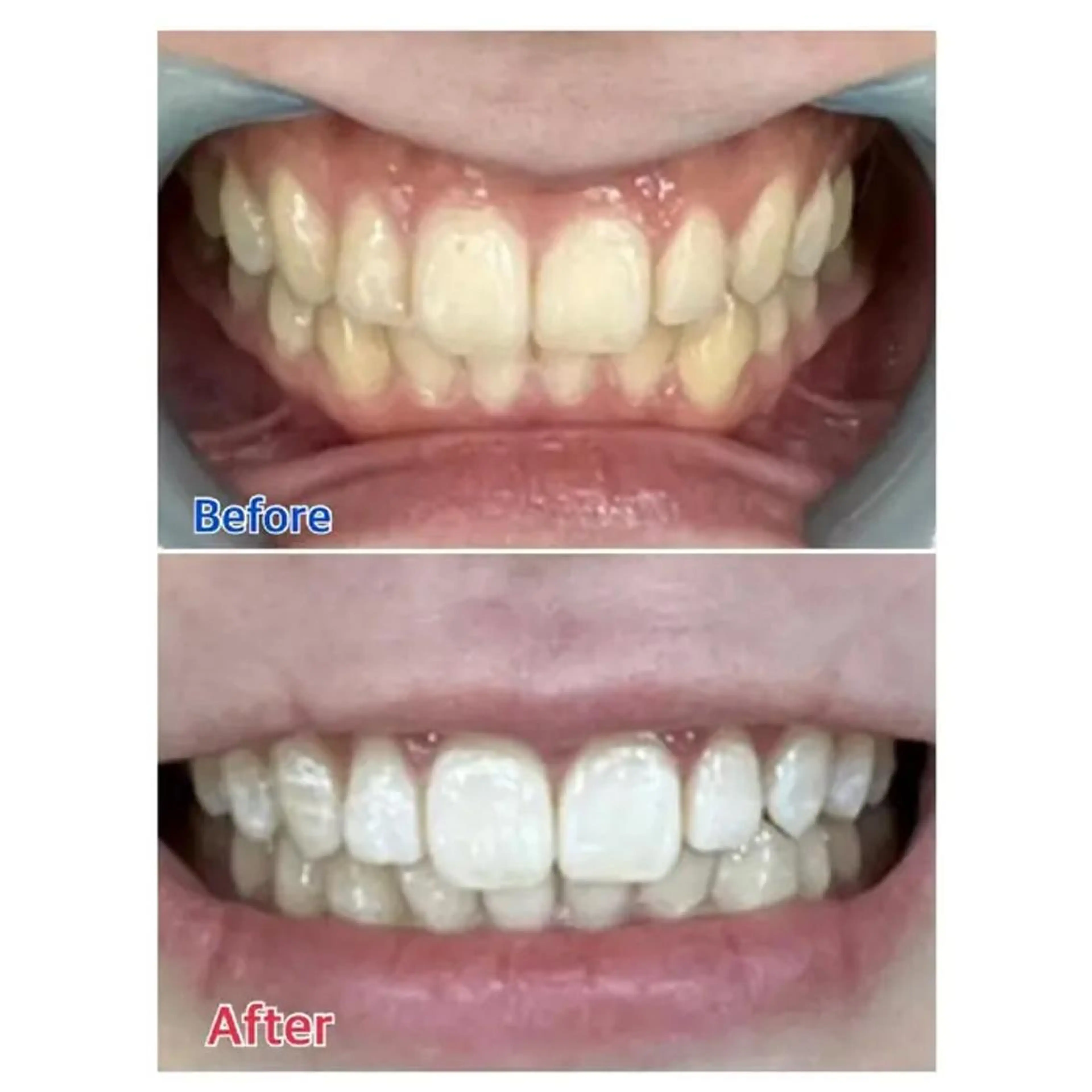 M渋谷 ホワイトニングのエステ・リラクイメージ