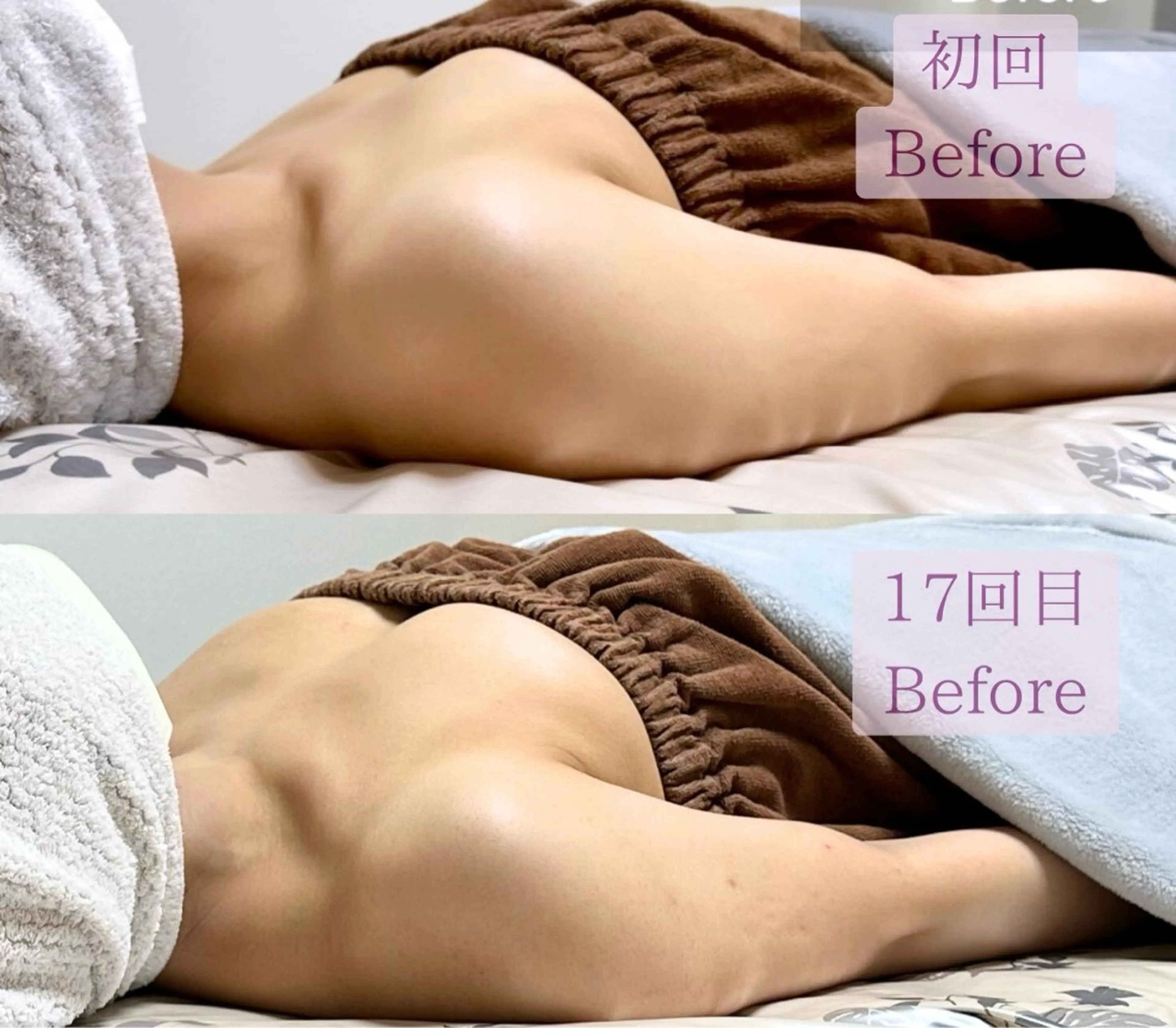 オールハンドのバストアップ技術💓筋膜にアプローチして全身を整えます。本気でバストアップしたい方だけお越し下さい。の写真