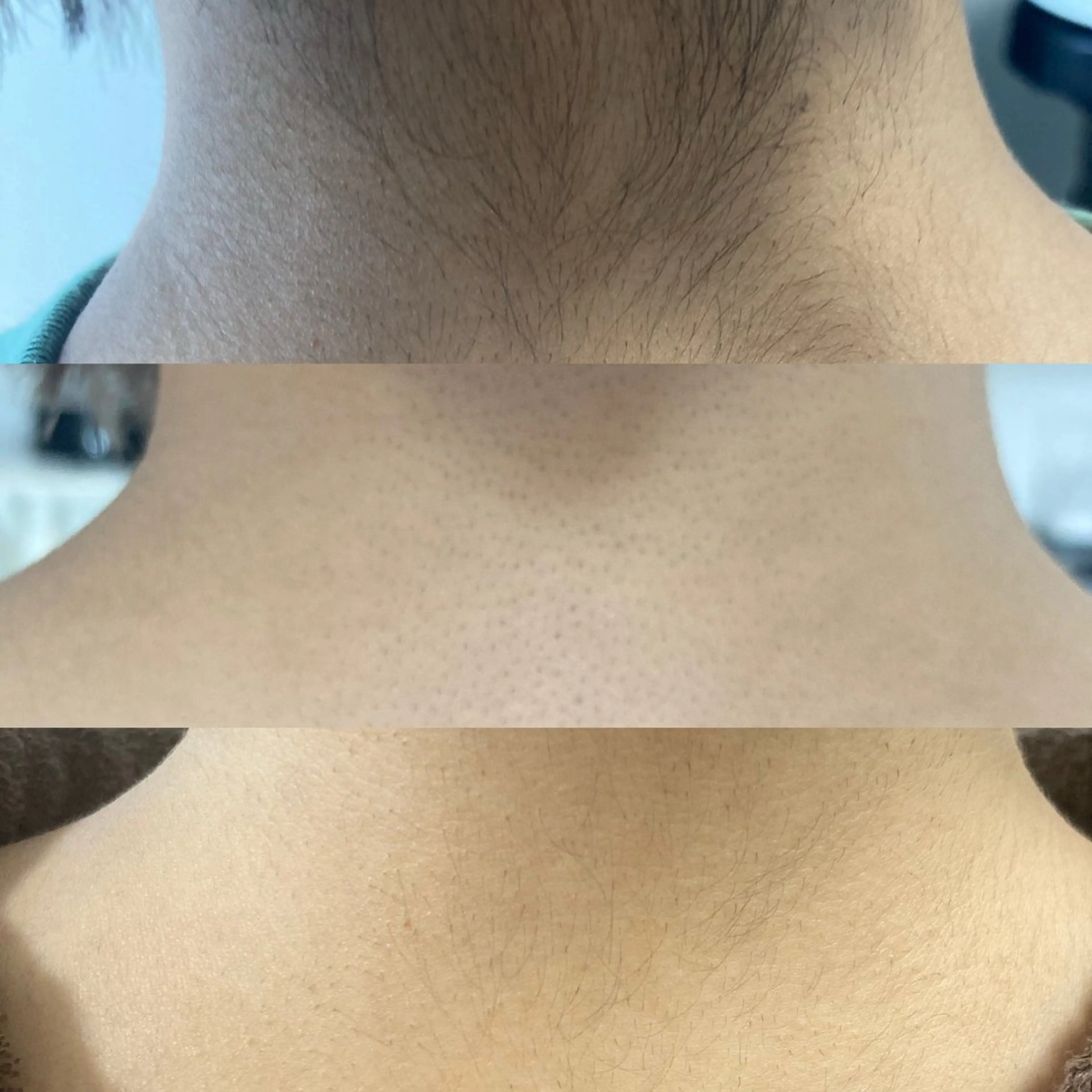 脱毛 谷口 多枝子のエステ・リラクイメージ