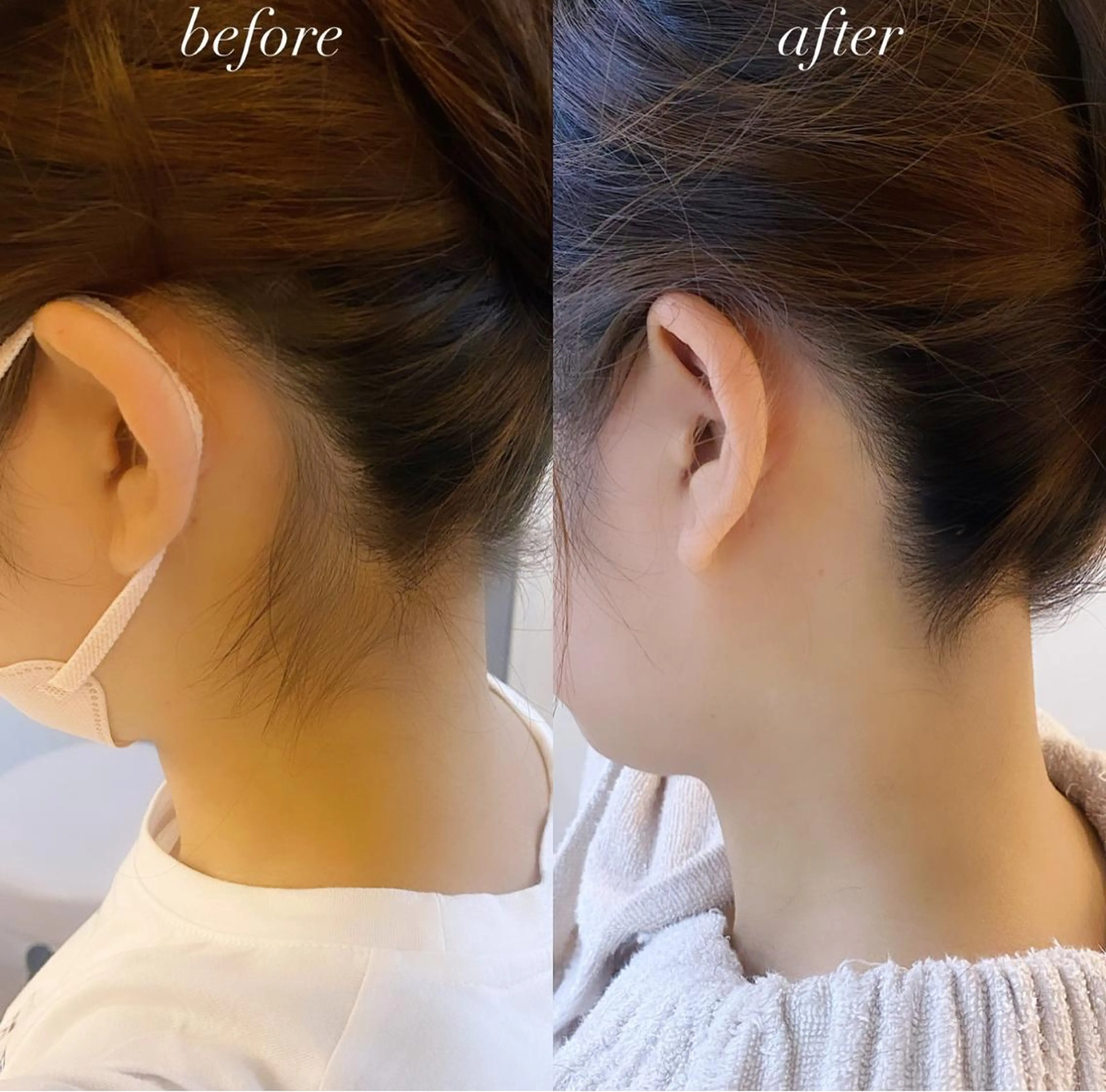 うなじ脱毛/美肌脱毛 LABELのエステ・リラクイメージ