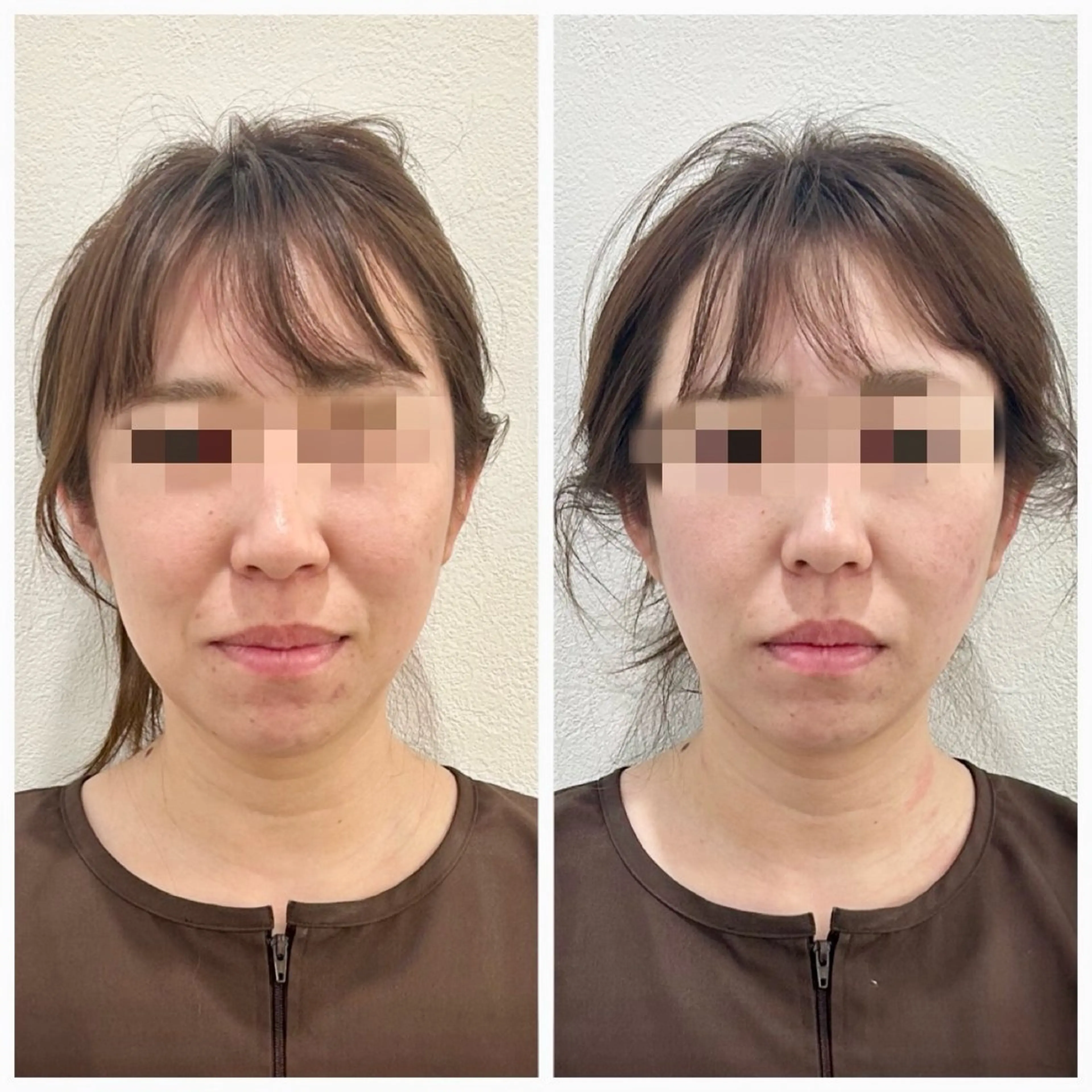 エステ リラク 鍼灸 ハリカラのエステ・リラクイメージ