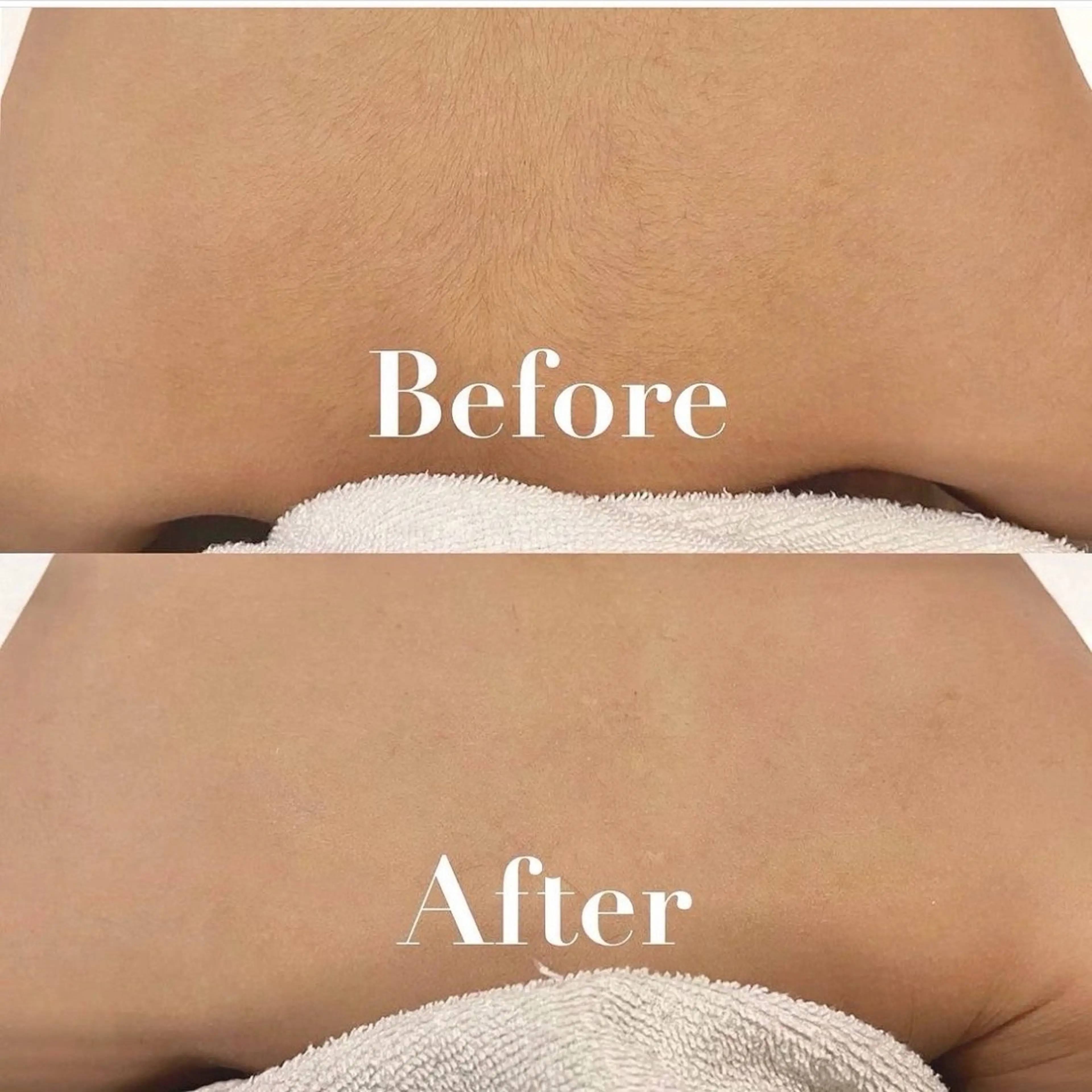 L’Beige レベージュのエステ・リラクイメージ