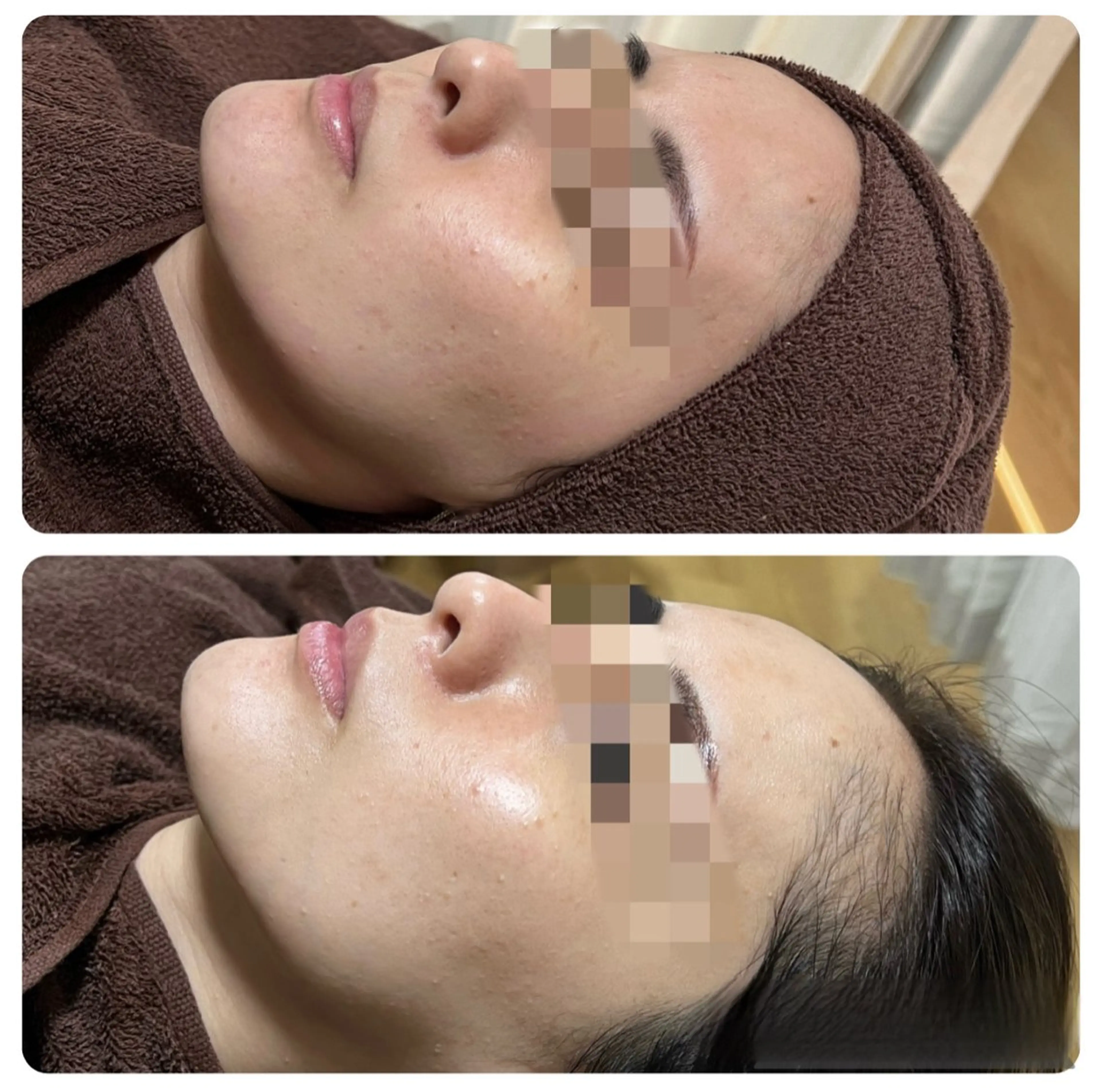 Chii Salon ネイル/痩身エステのネイルデザイン