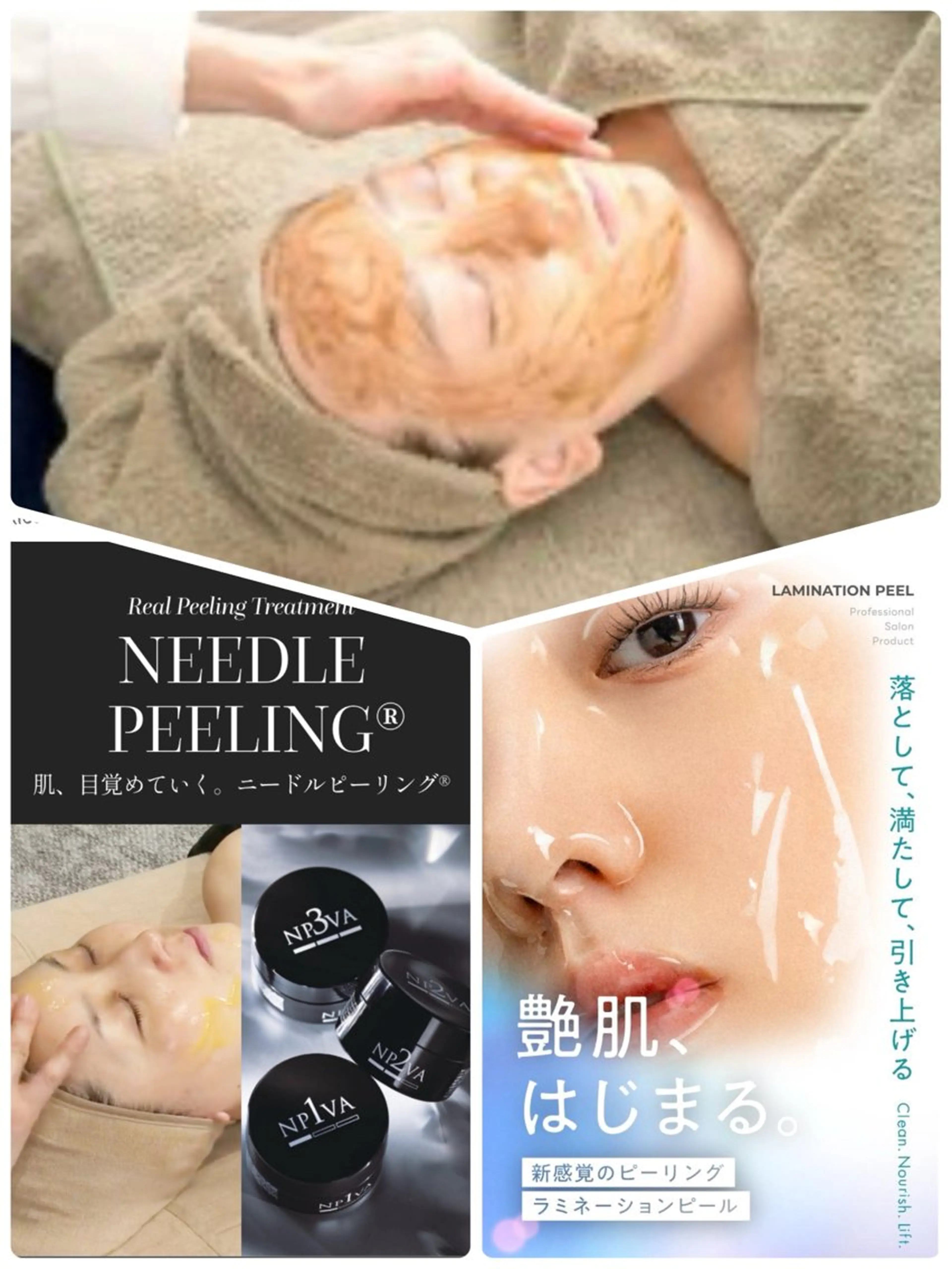 10周年記念💐選べるピーリングコース　碧ハーブ🌿/微細針ピーリング/ラミネーションピーリング　翌日よりメイクOK✨✨の写真