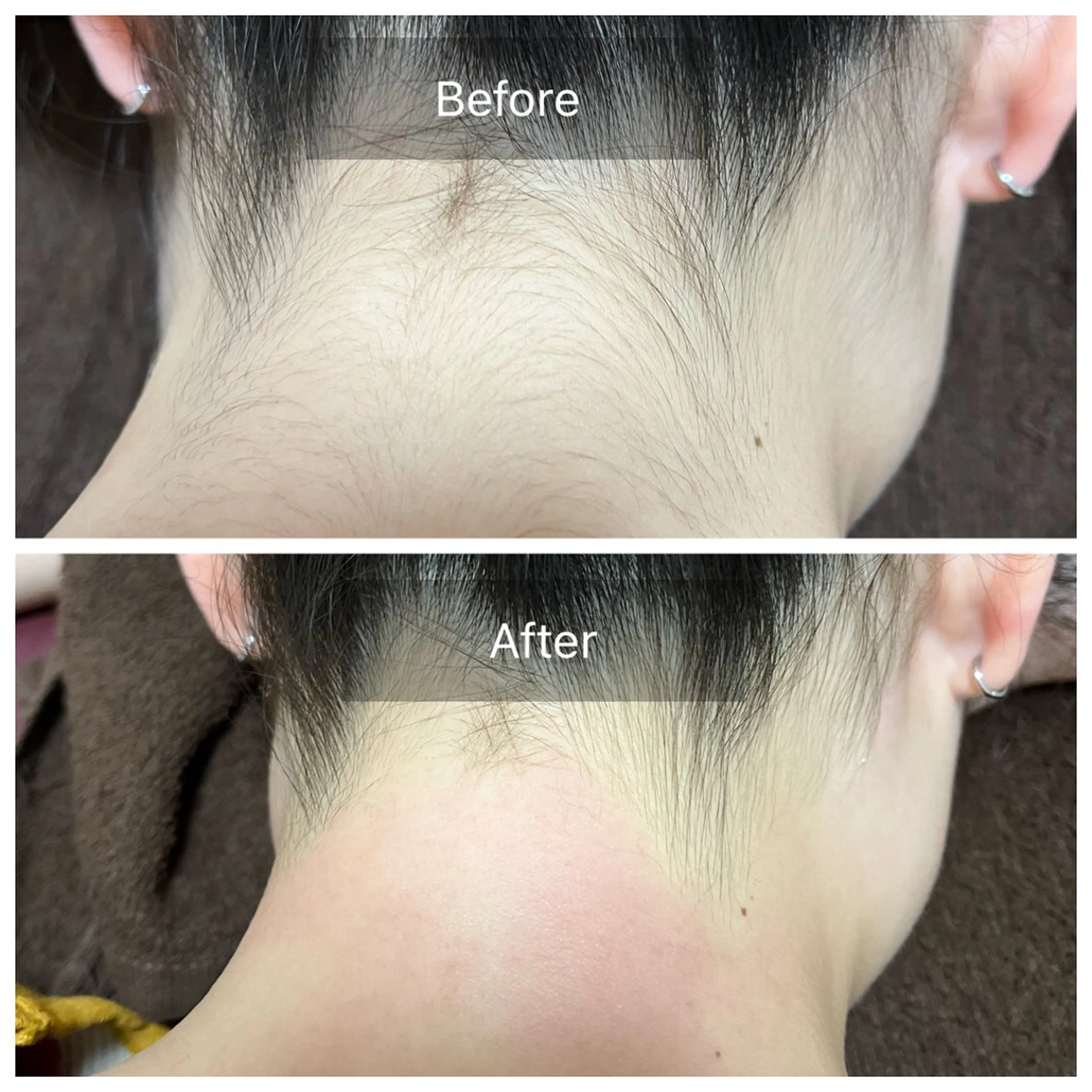 脱毛 Salon Improveのネイルデザイン