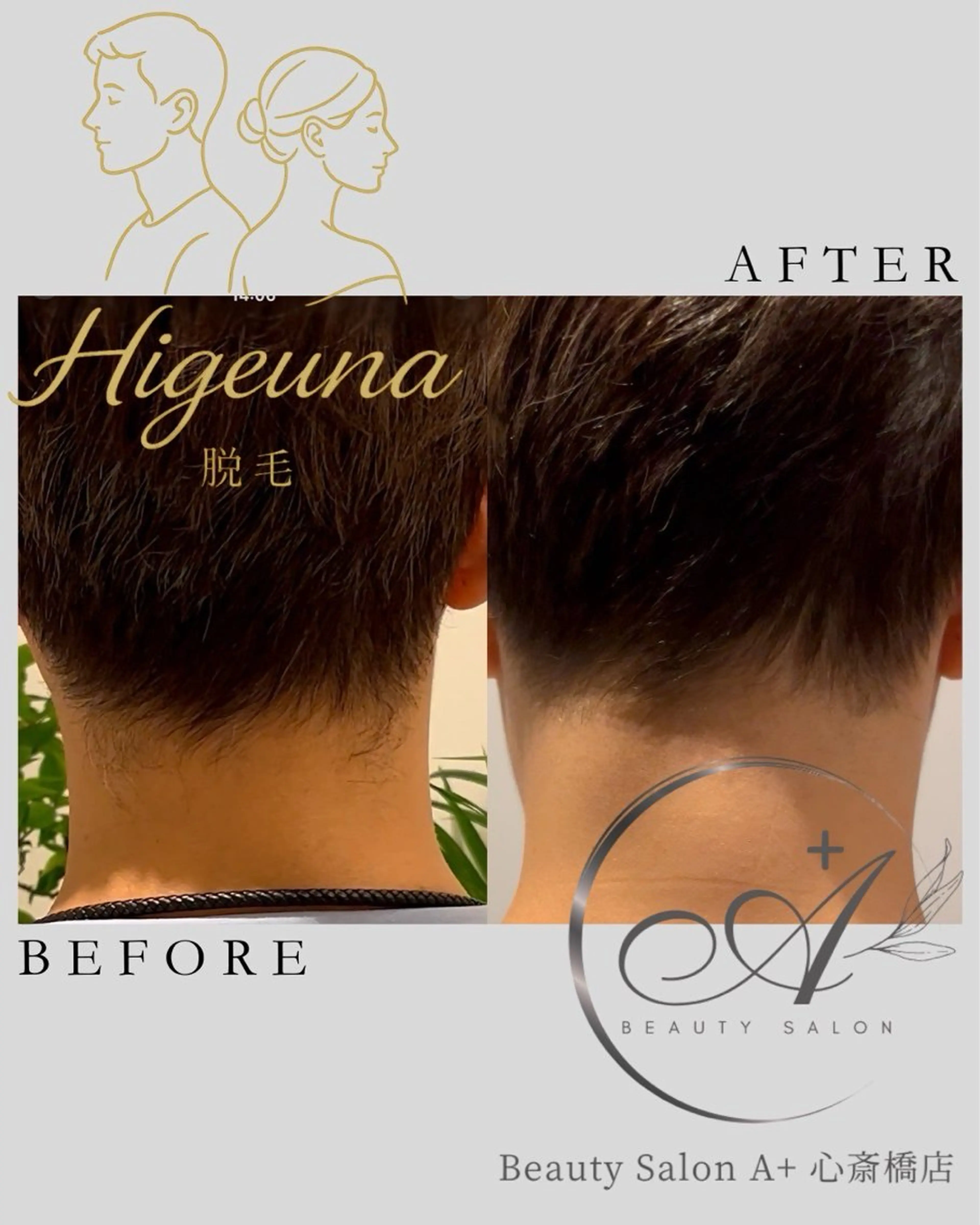 脱毛 うなじ脱毛/ つや肌ハーブのエステ・リラクイメージ