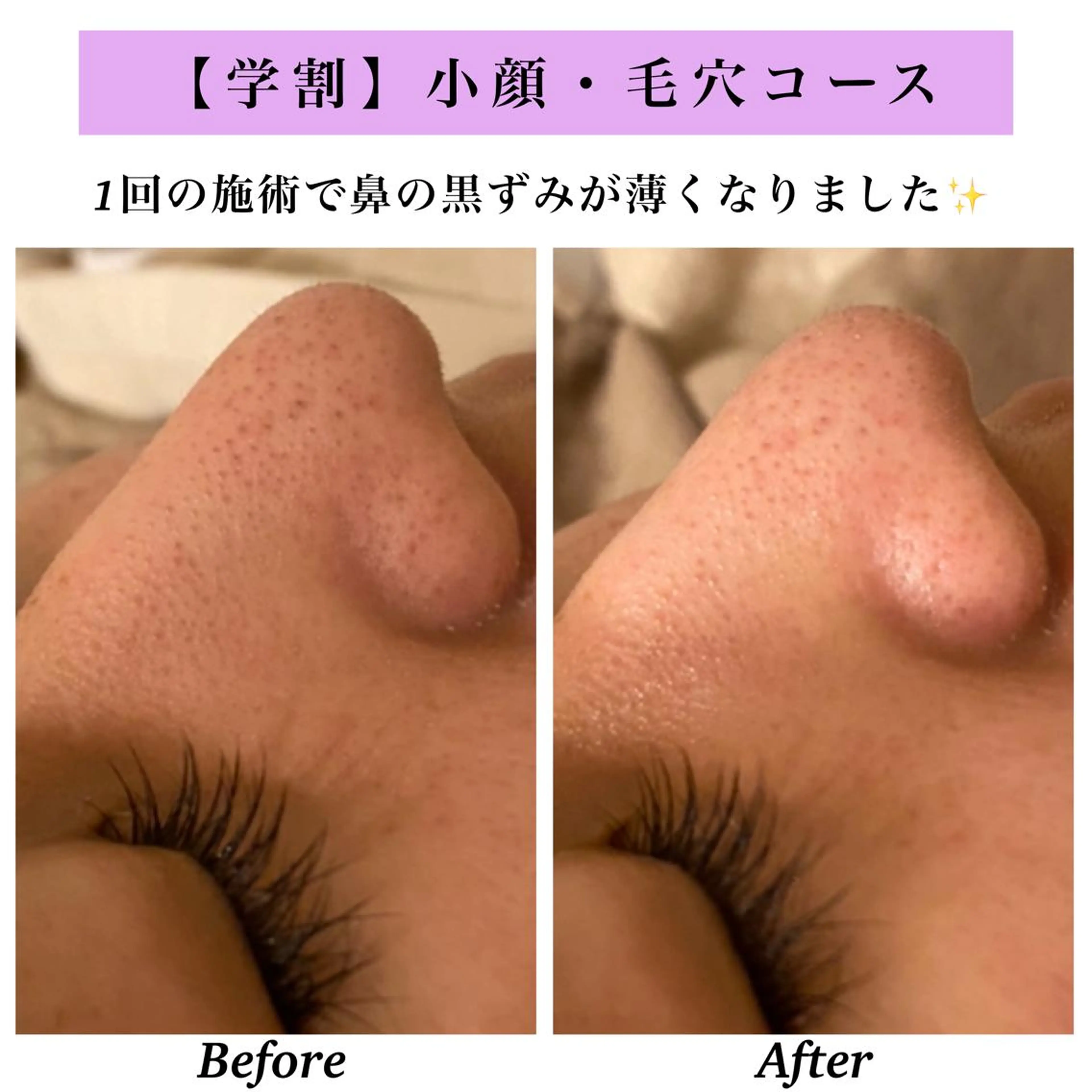 Bellesthe (ベルエステ)のエステ・リラクイメージ