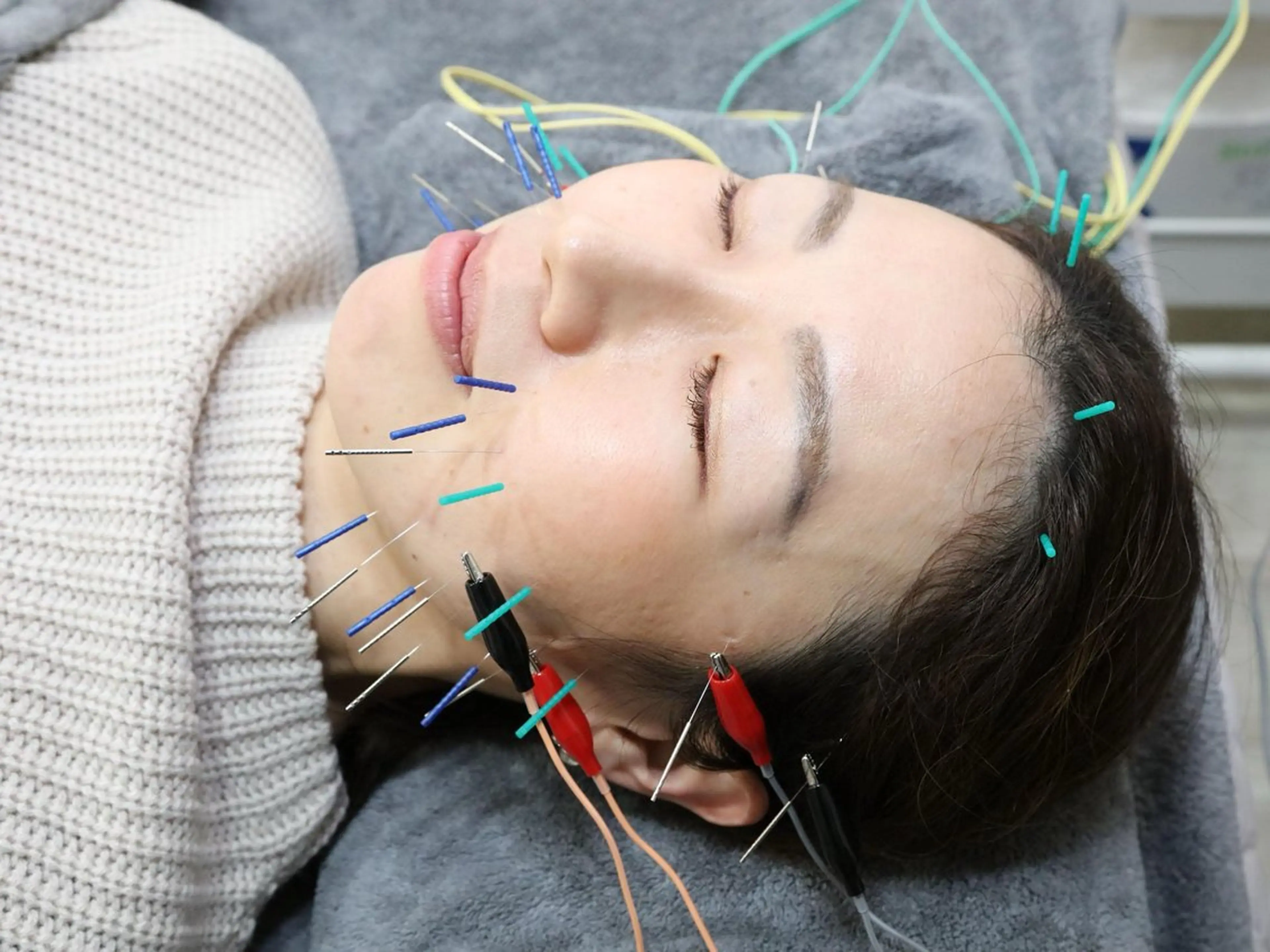 美容鍼脱毛salon リノン吹田駅前店のエステ・リラクイメージ