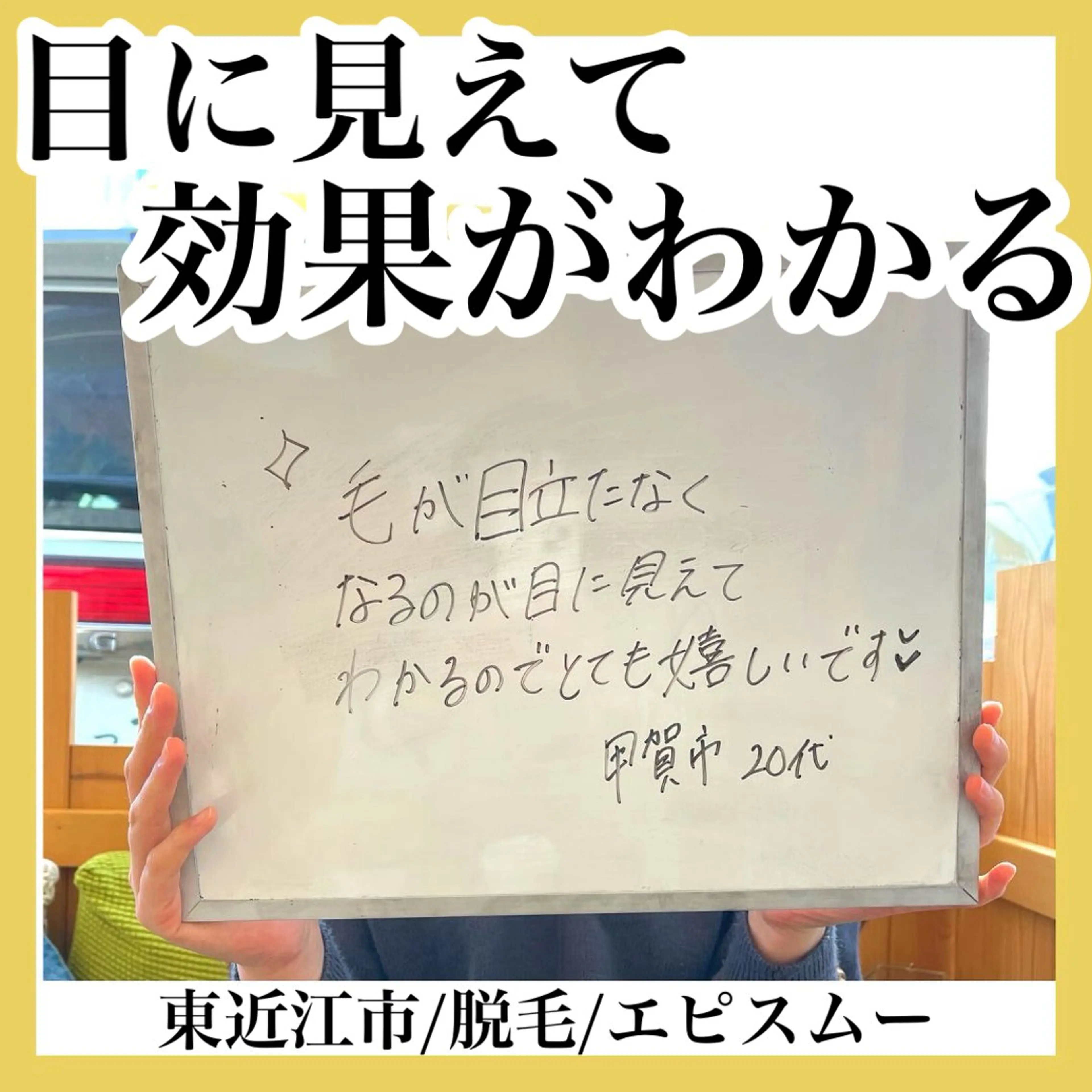 脱毛 epismoo 脱毛/HBL/毛穴の眉毛・アイブロウイメージ
