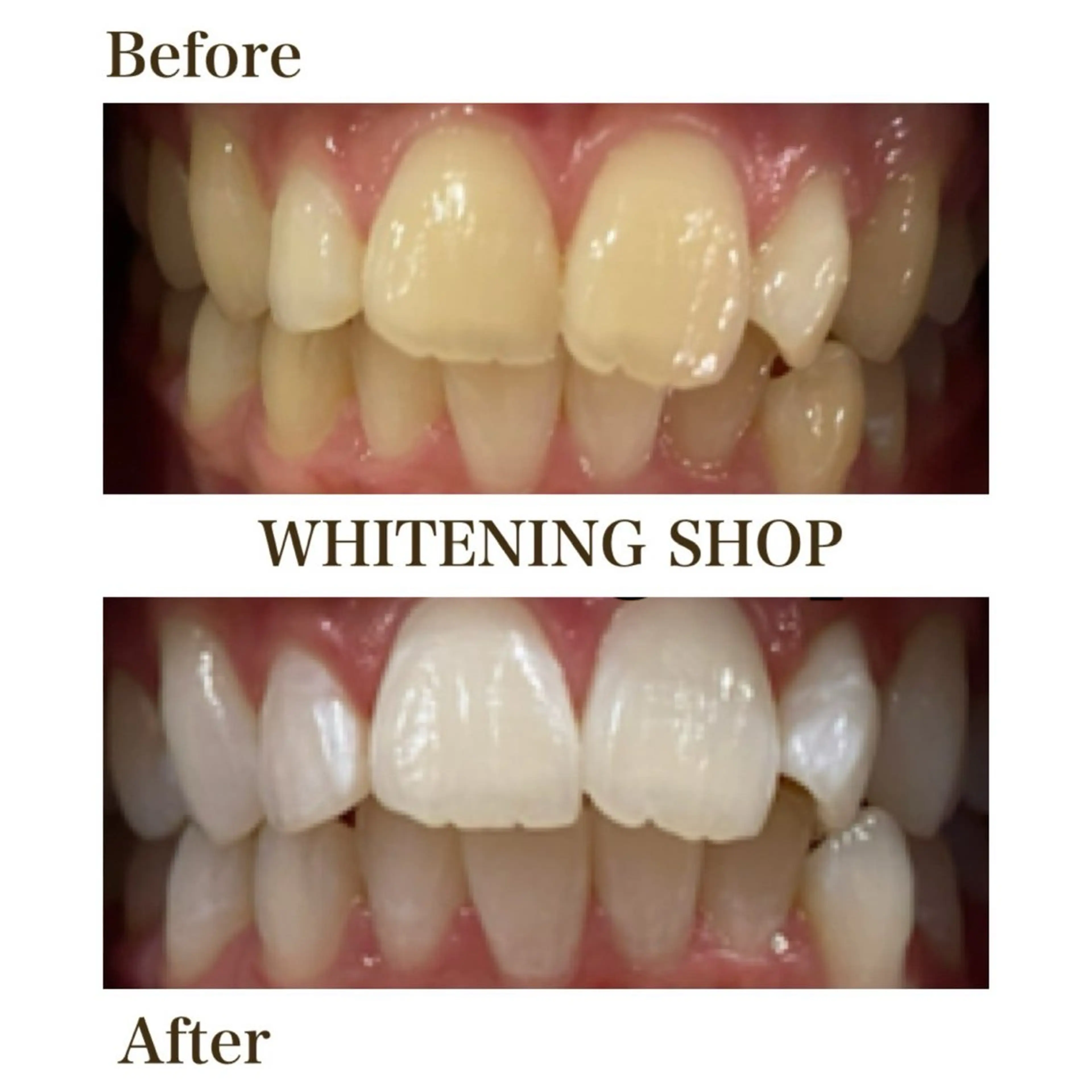 その他 ホワイトニング ショップ葵区静岡駅店のその他イメージ