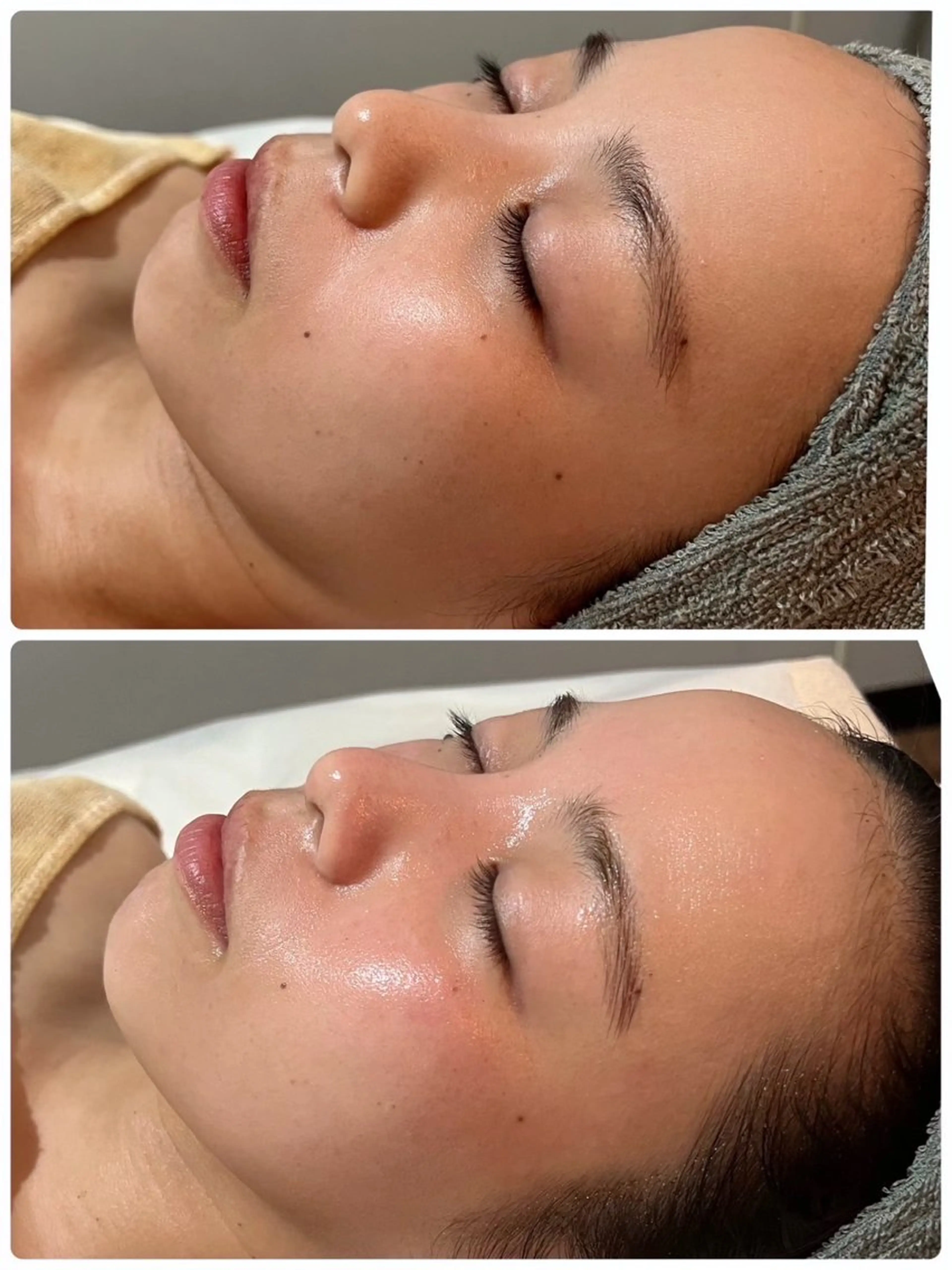 エステ mignon /栄のエステ・リラクイメージ