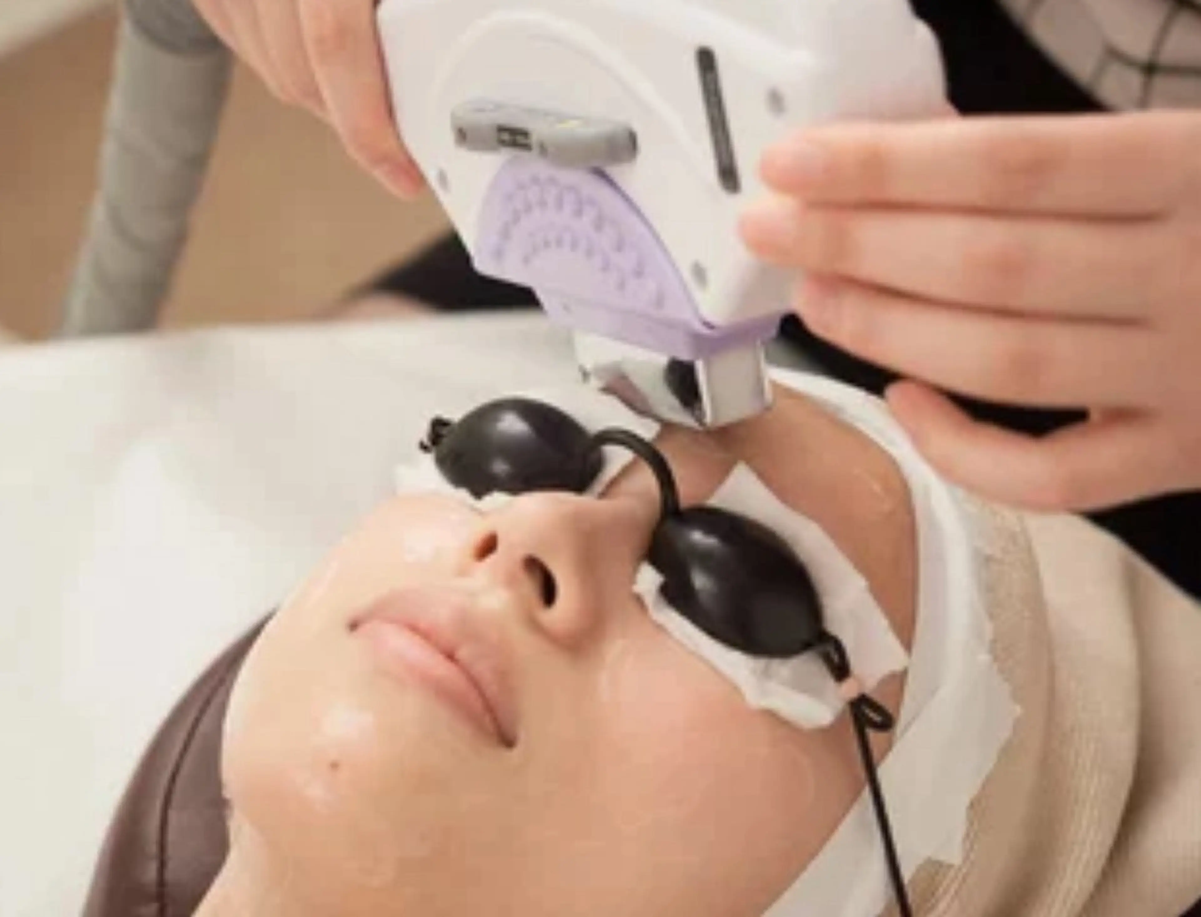 初回限定価格🔰《レディース顔脱毛🌱》(頬、口周り、額、フェイスライン)の写真