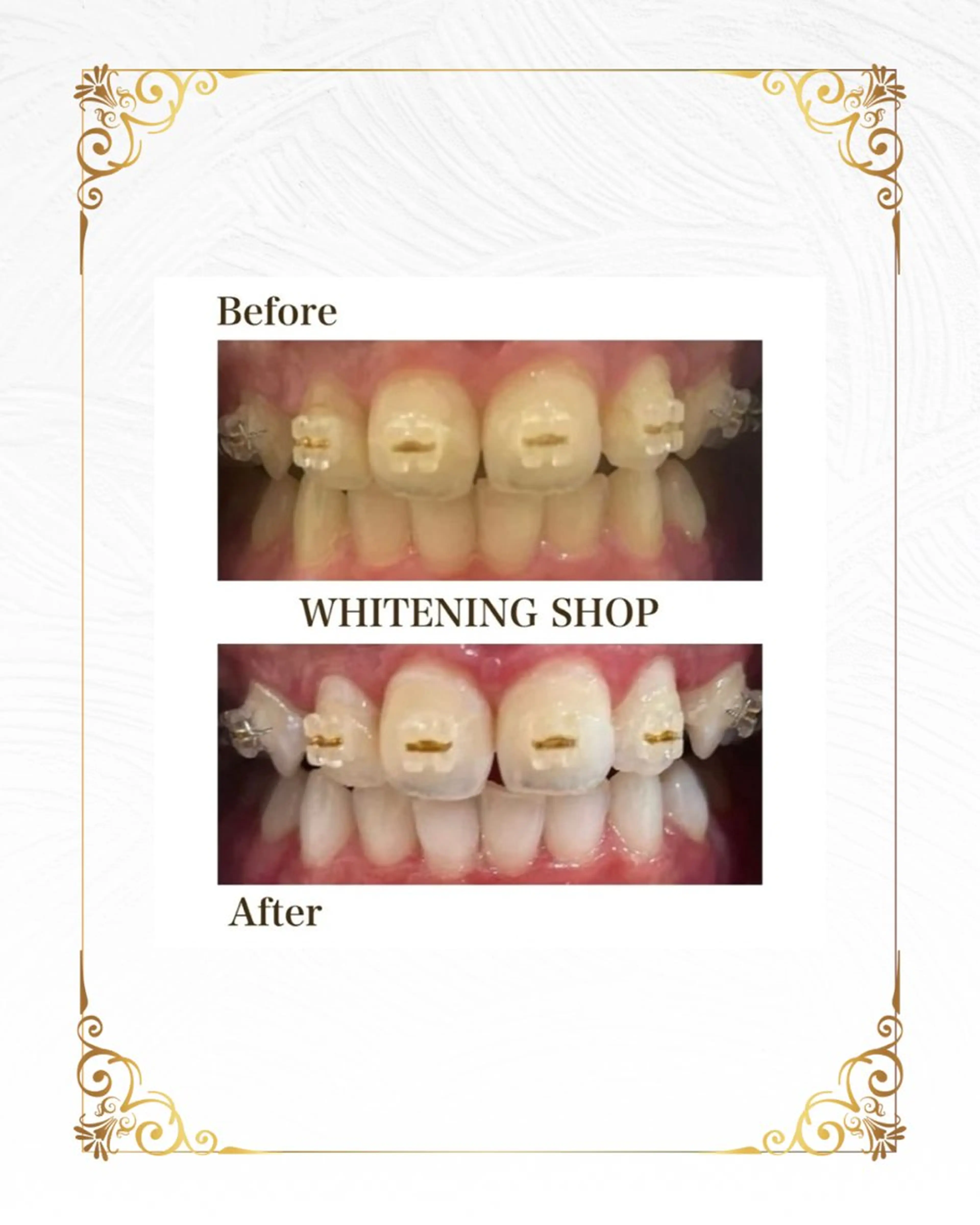 ホワイトニング ショップ葵区静岡駅店のその他イメージ